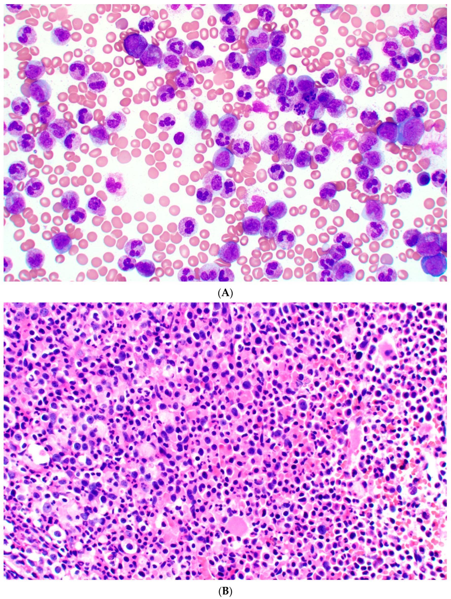 Cancers 17 00227 g001a