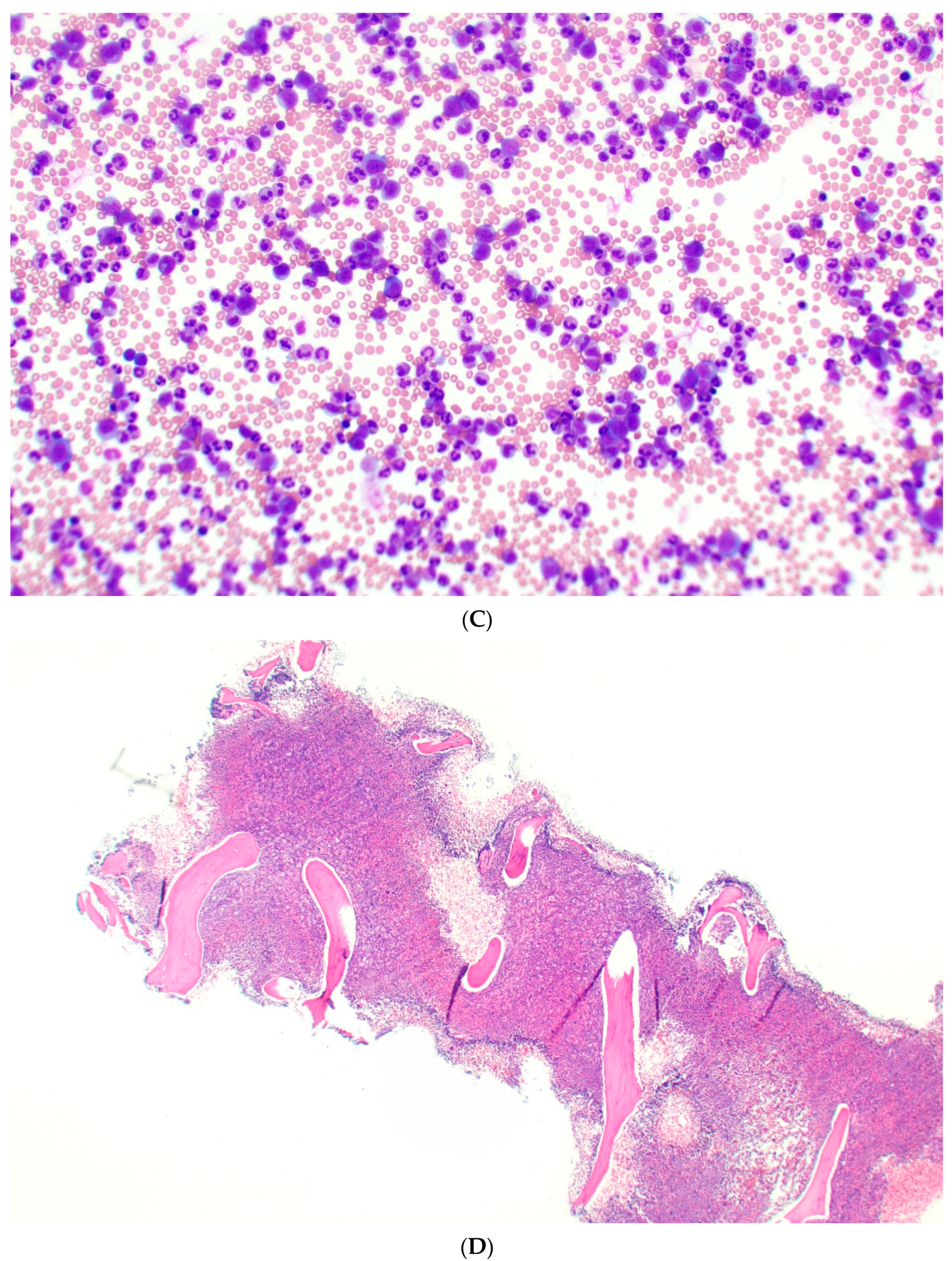 Cancers 17 00227 g001b