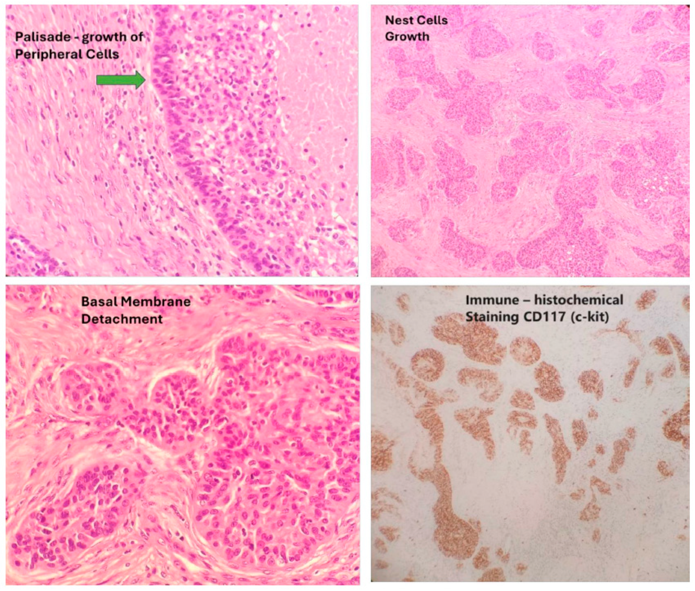 Cancers 17 00239 g001