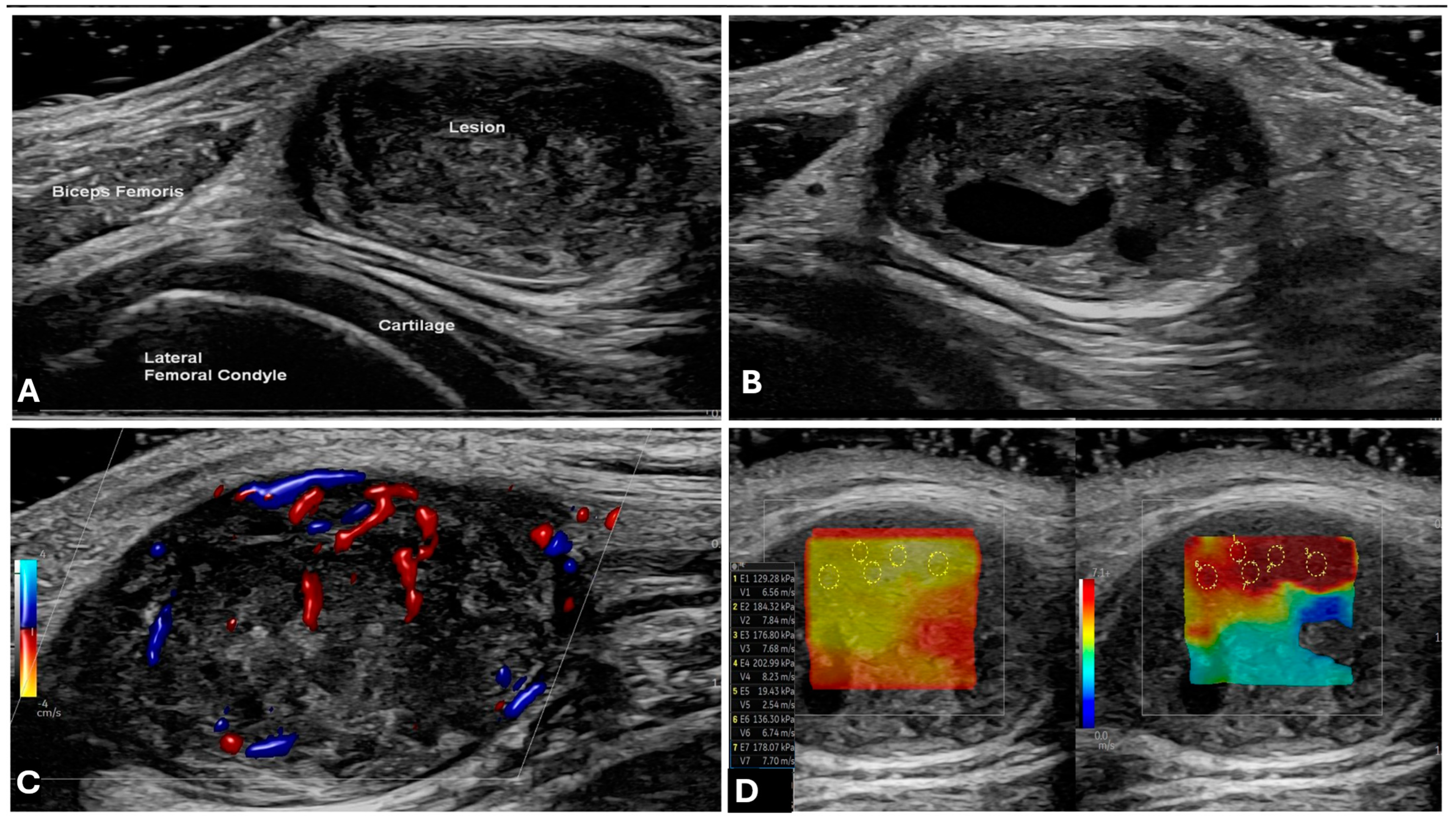 Cancers 17 00246 g002