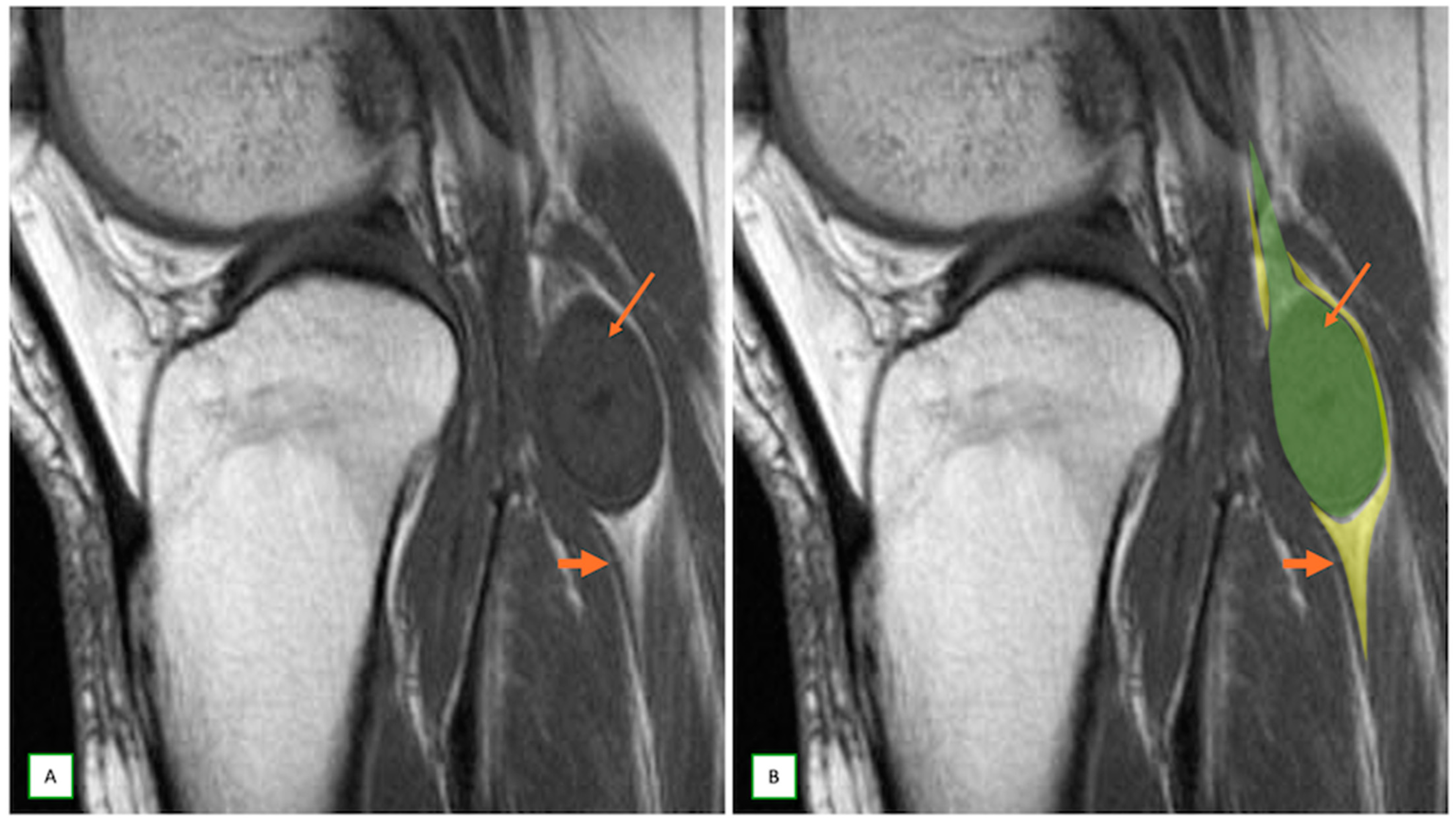 Cancers 17 00246 g003