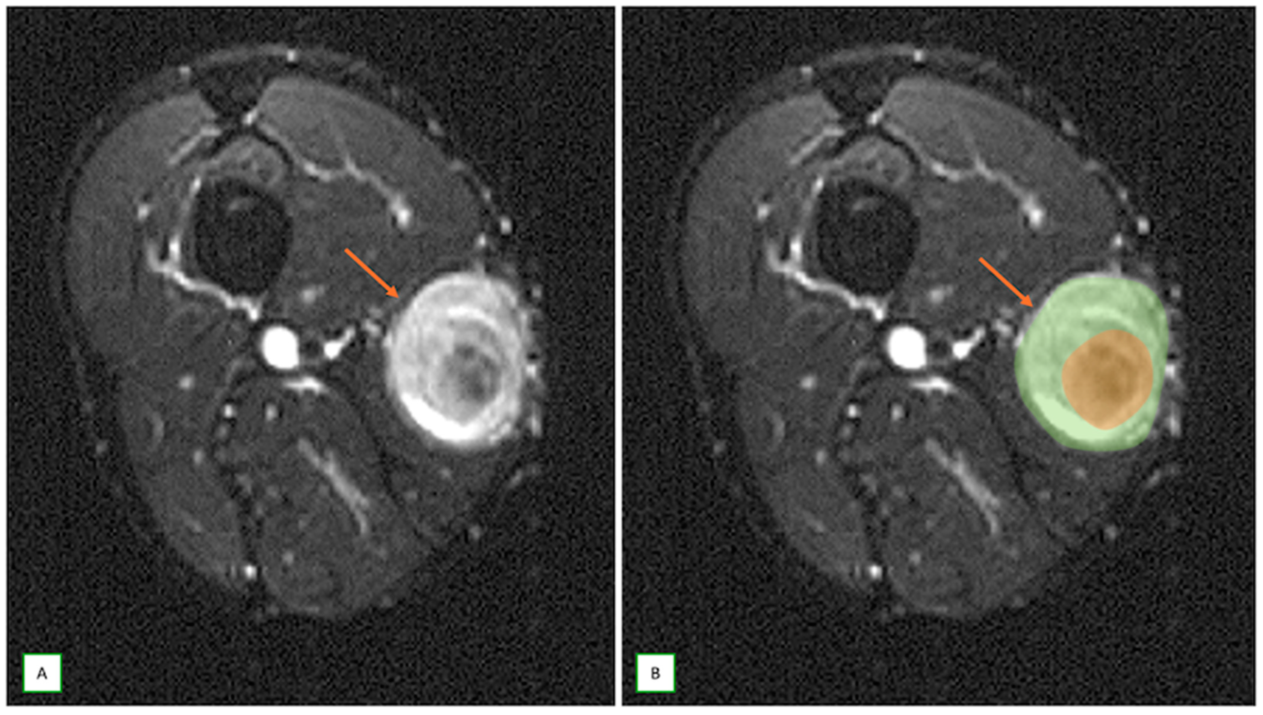 Cancers 17 00246 g004