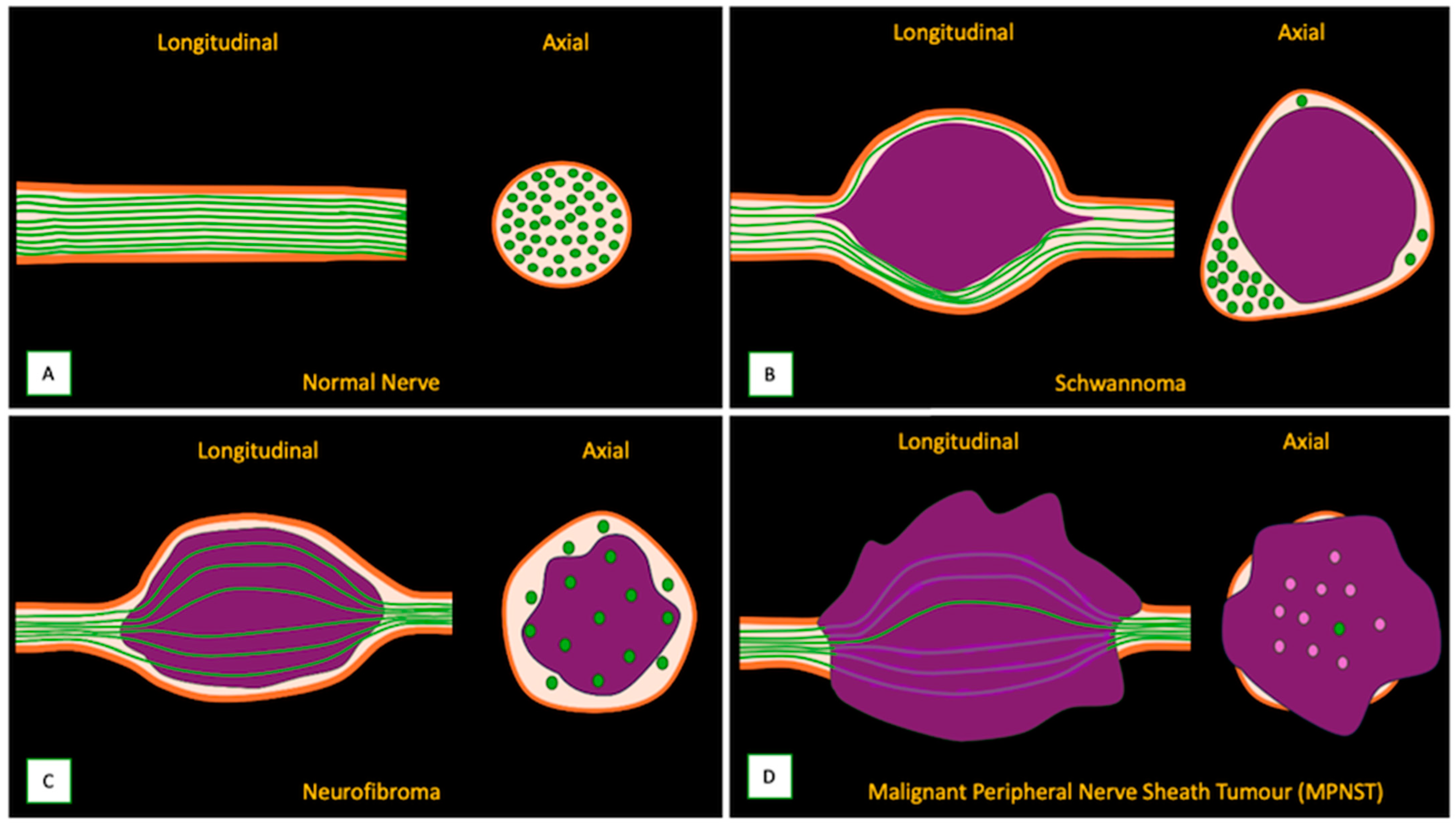 Cancers 17 00246 g007