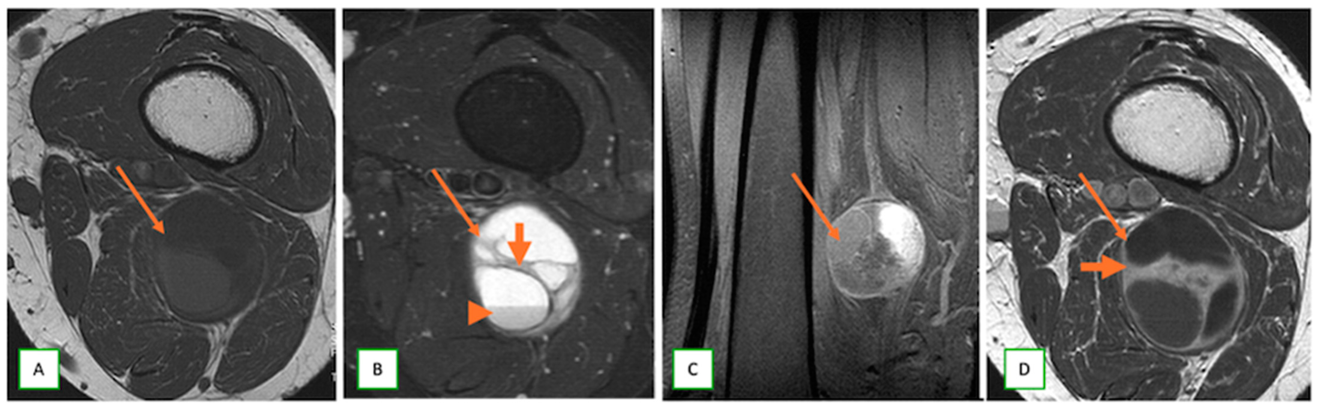 Cancers 17 00246 g008
