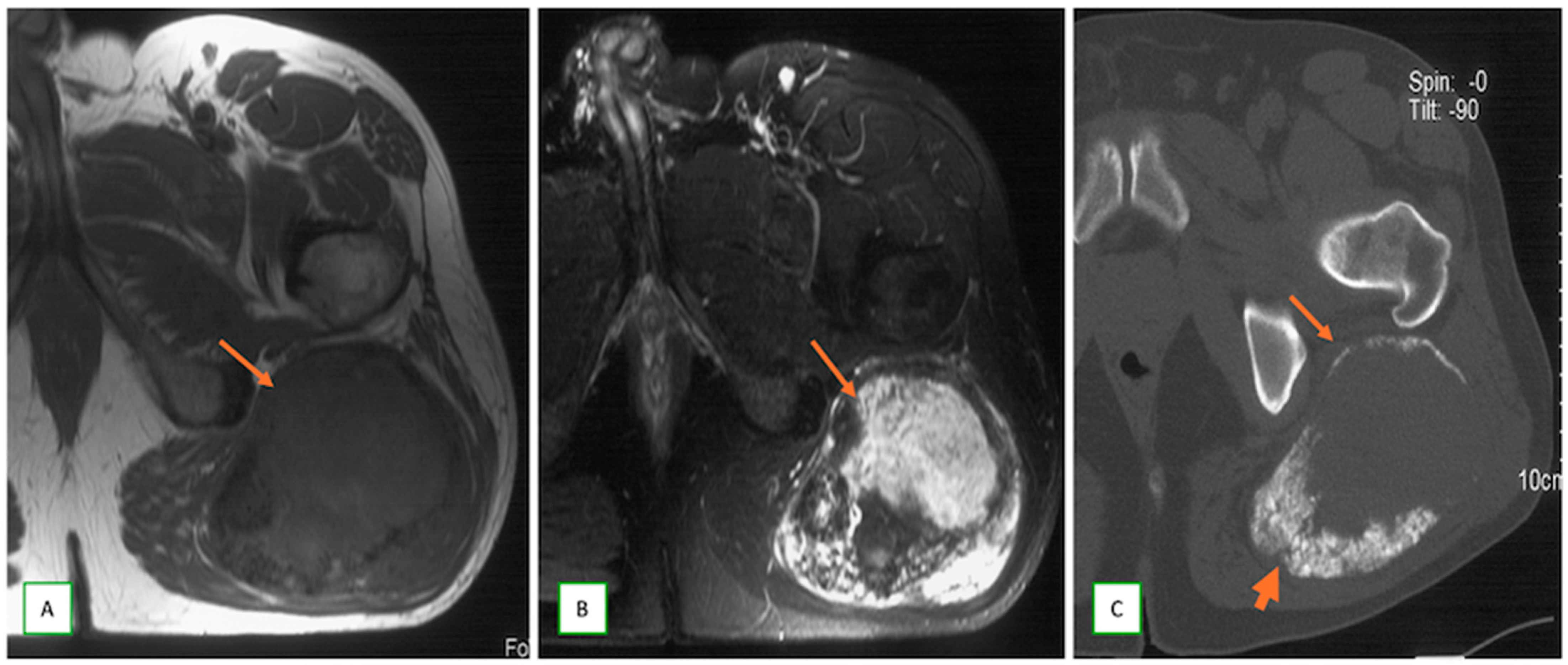 Cancers 17 00246 g009