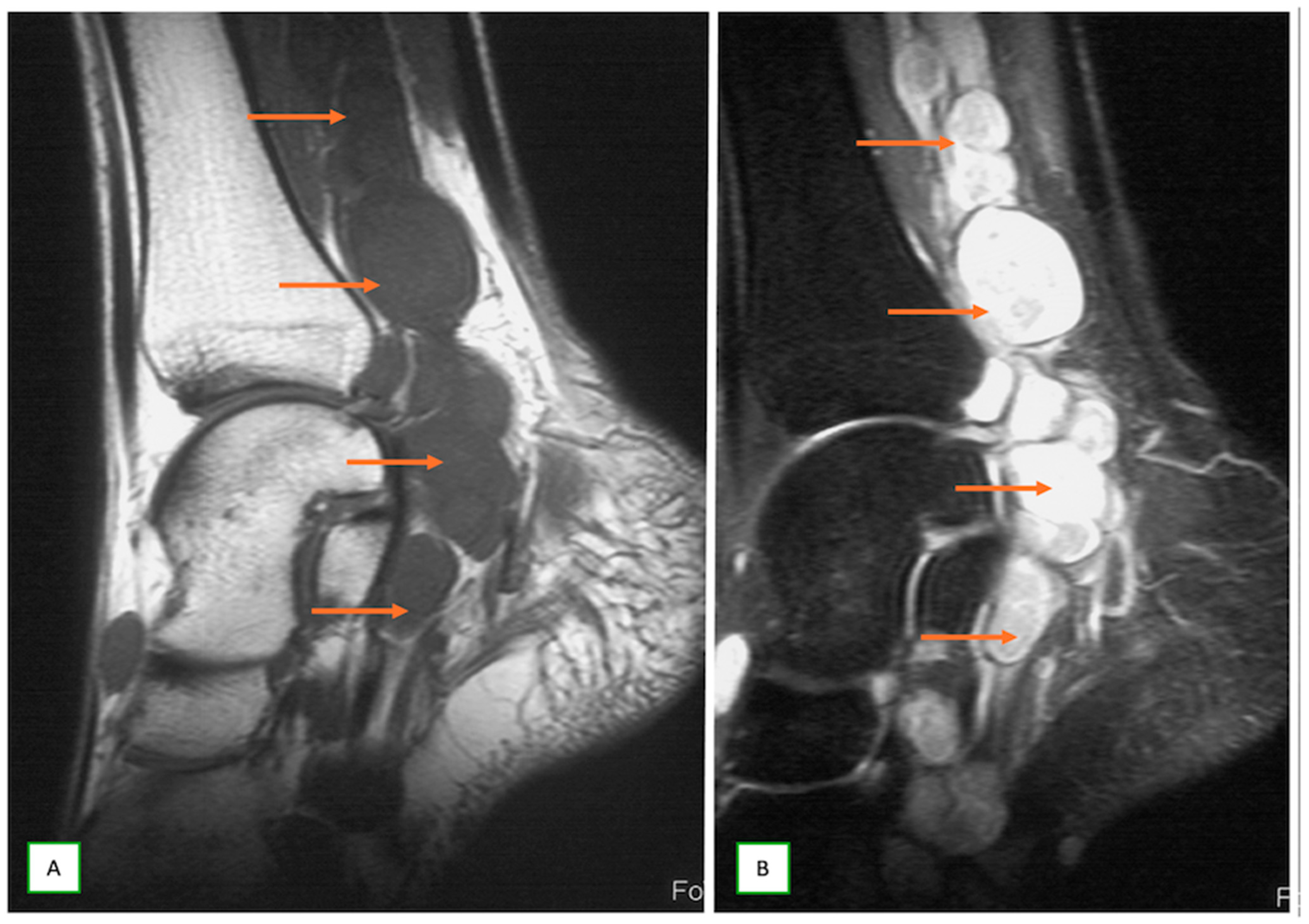 Cancers 17 00246 g012