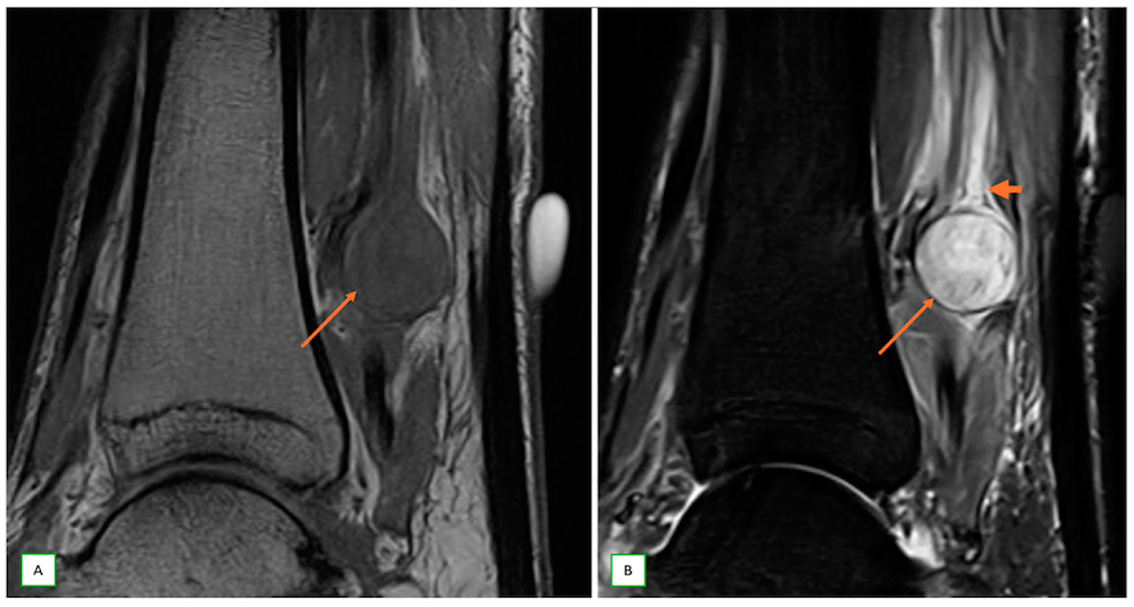 Cancers 17 00246 g013