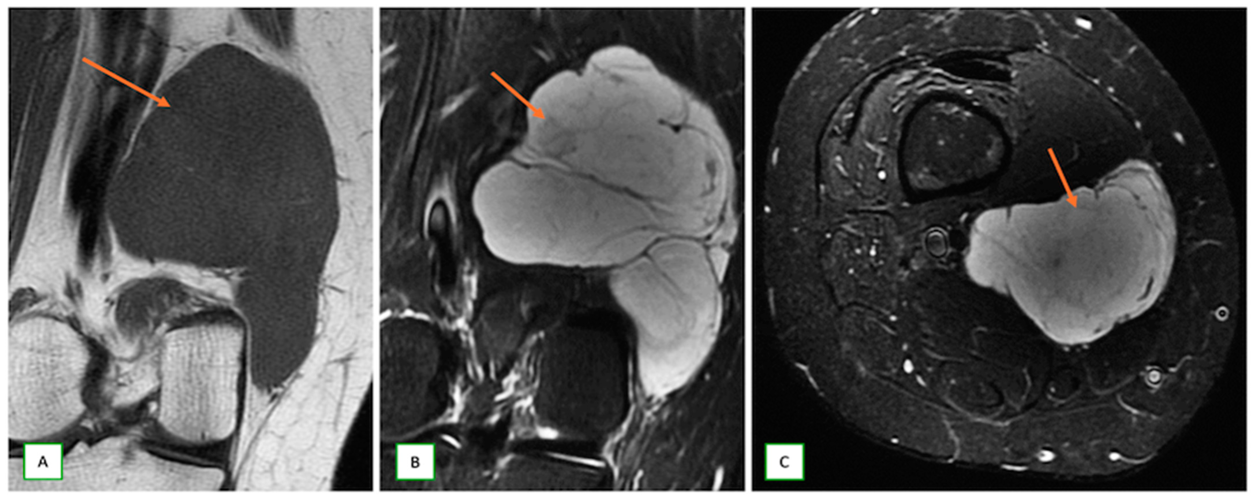 Cancers 17 00246 g014