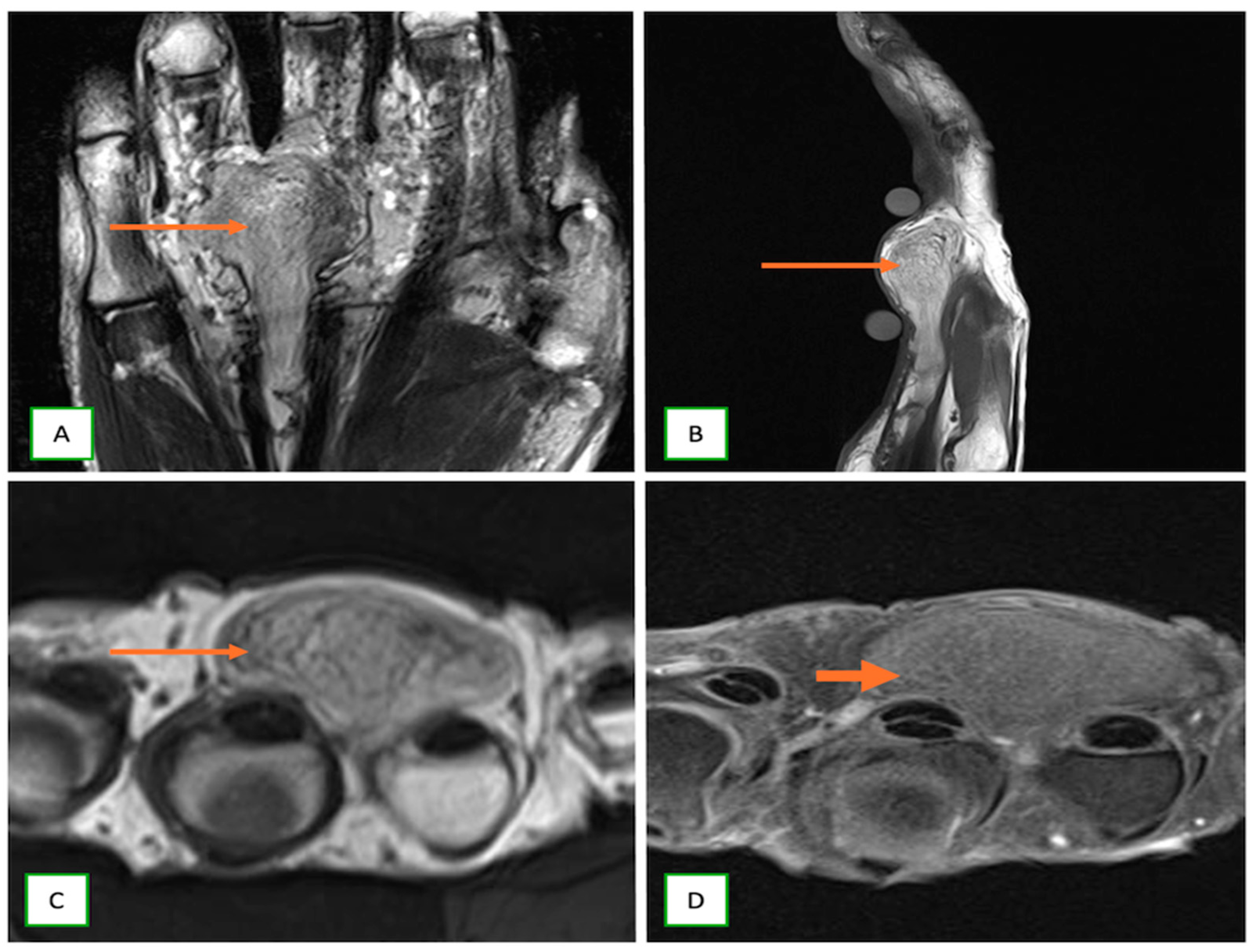 Cancers 17 00246 g015