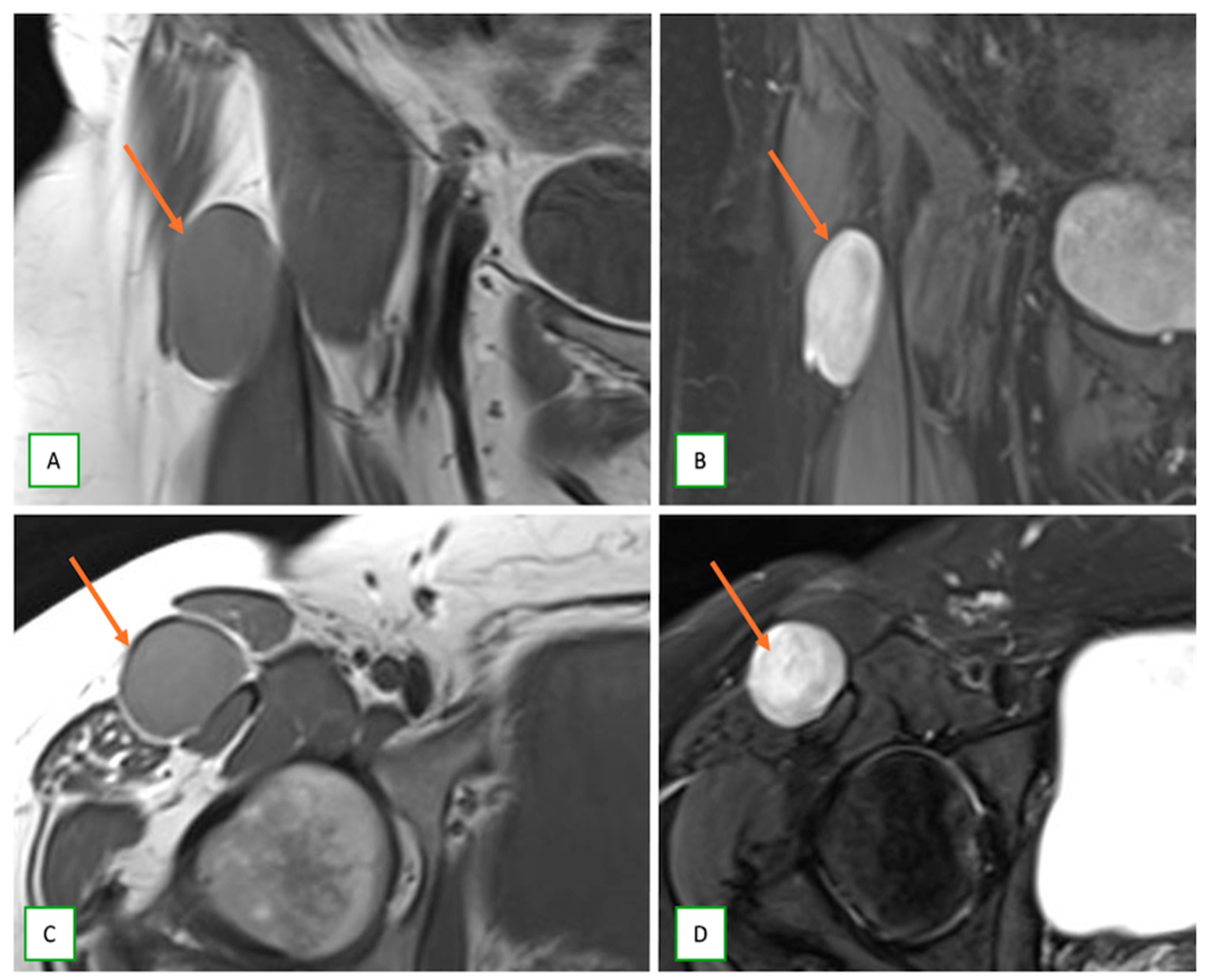 Cancers 17 00246 g017