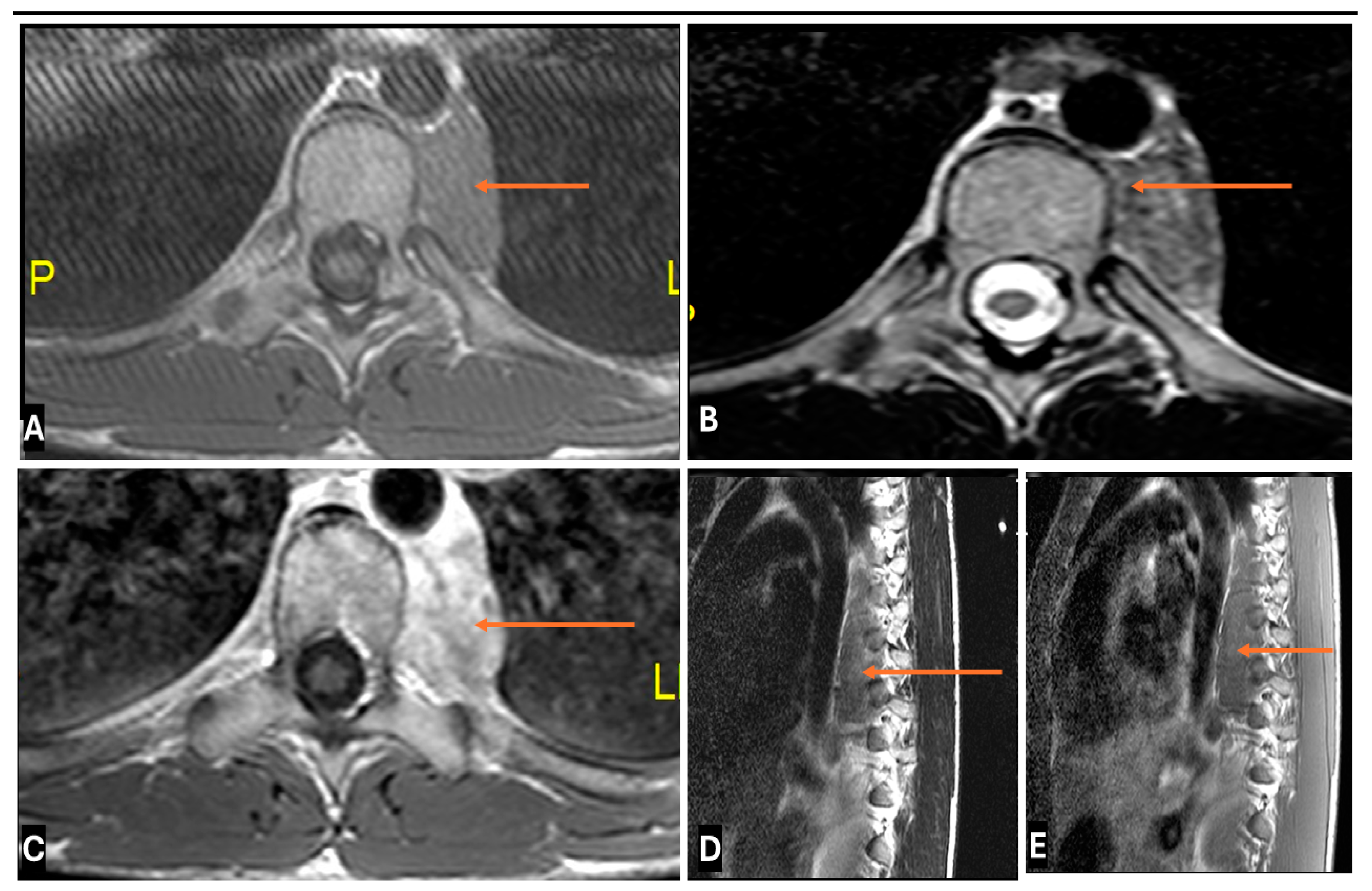 Cancers 17 00246 g019