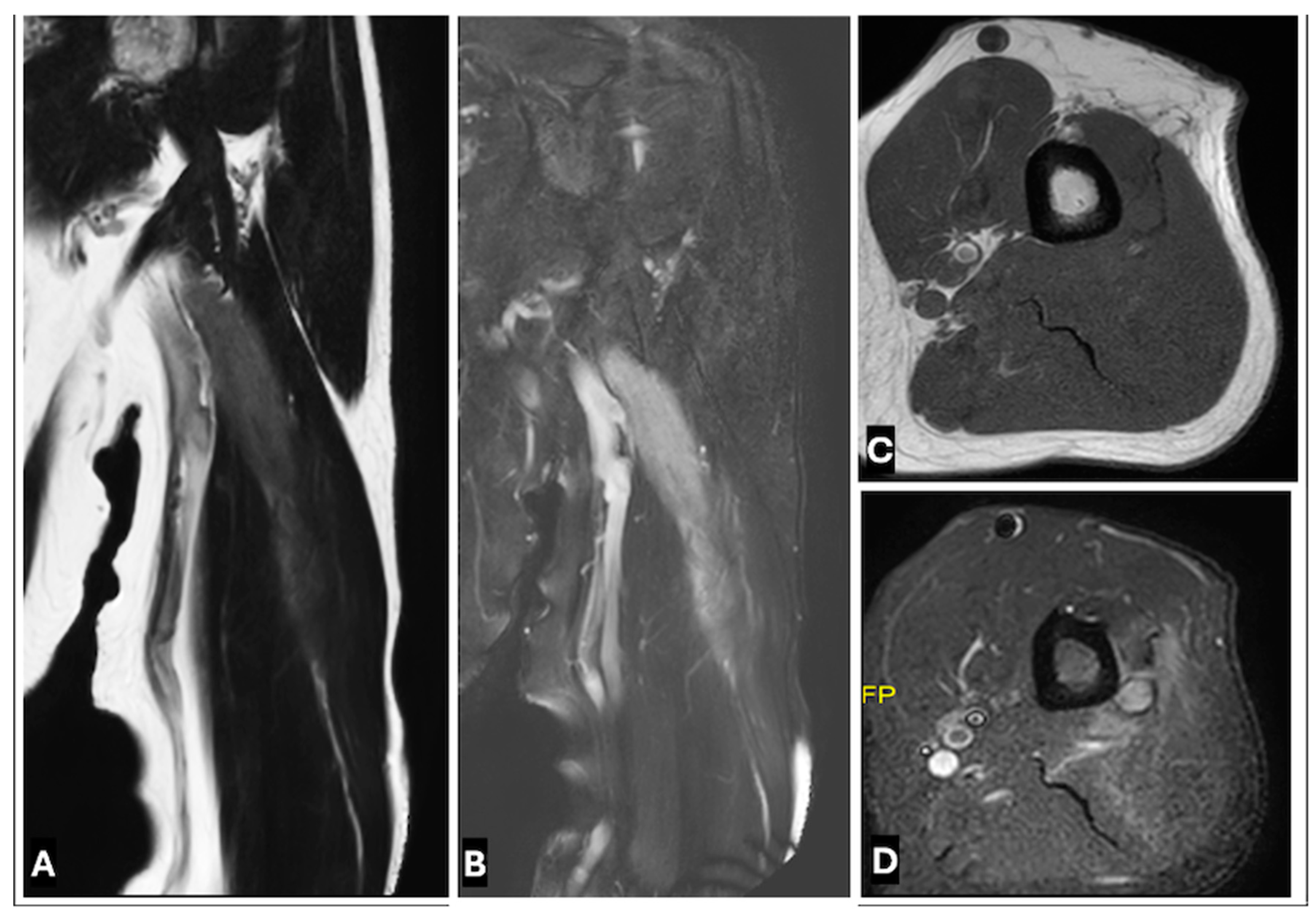 Cancers 17 00246 g020