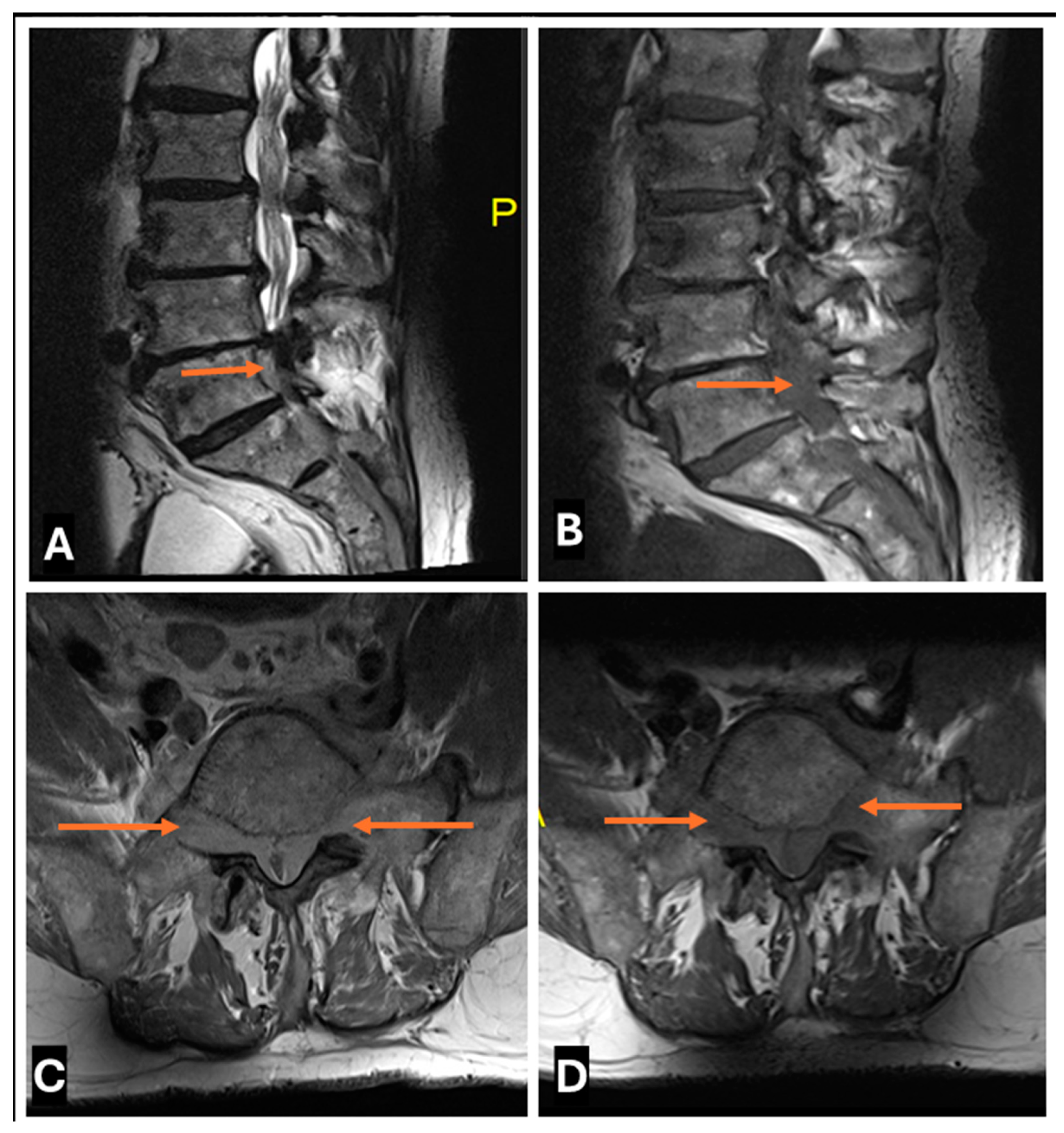 Cancers 17 00246 g021