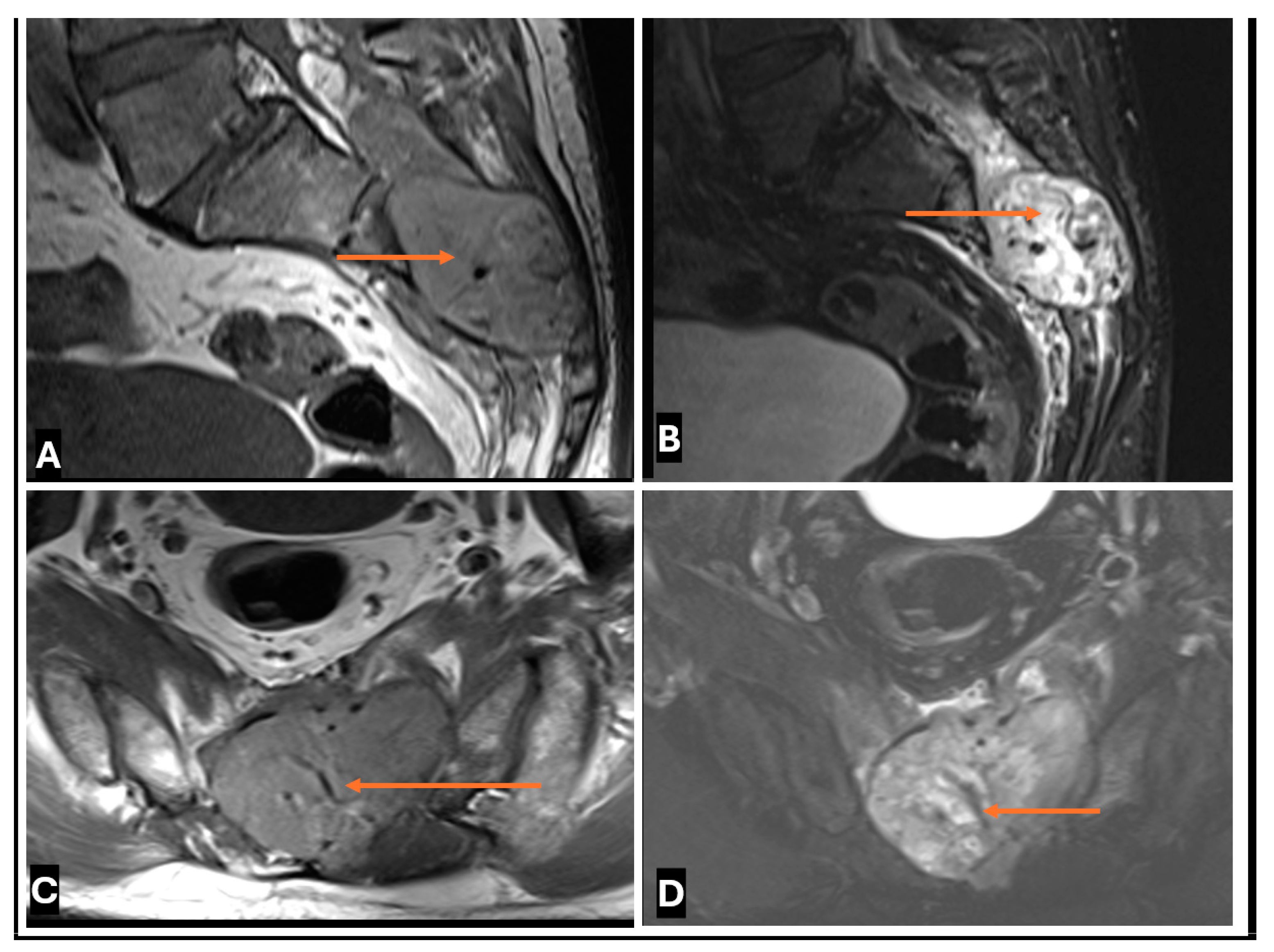 Cancers 17 00246 g022
