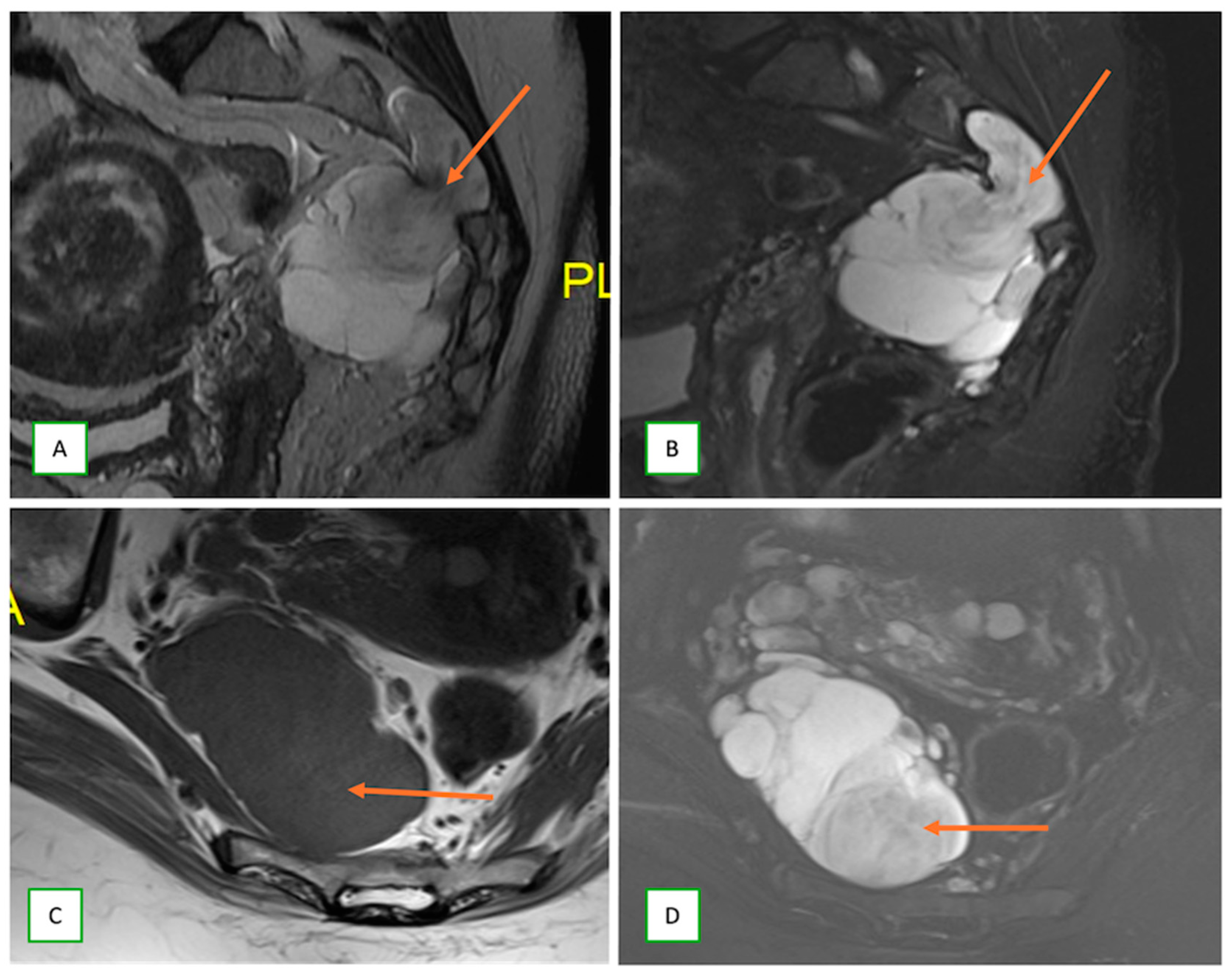 Cancers 17 00246 g023