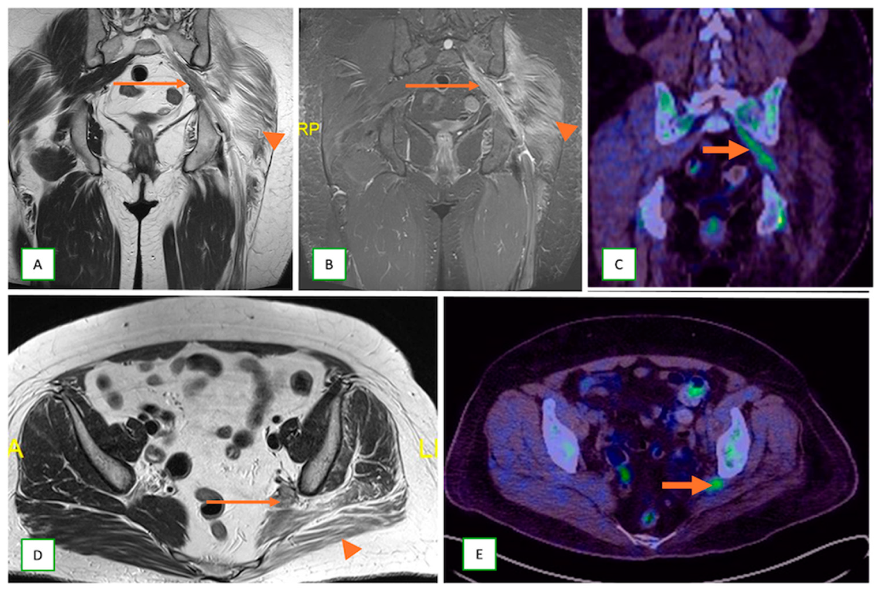 Cancers 17 00246 g024