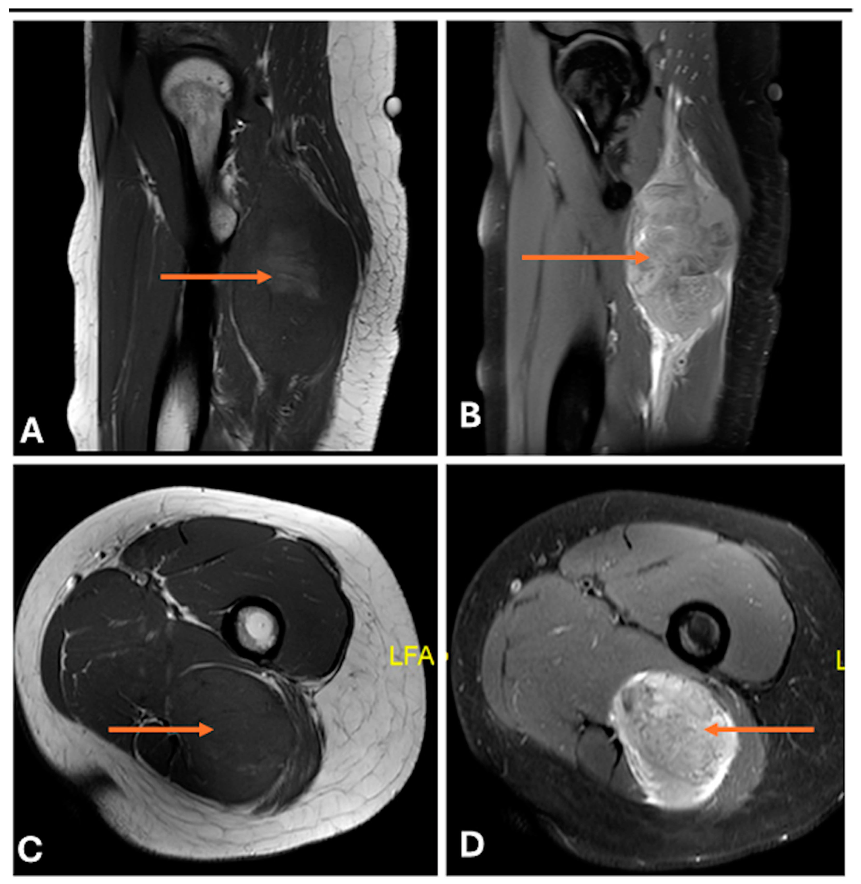 Cancers 17 00246 g026