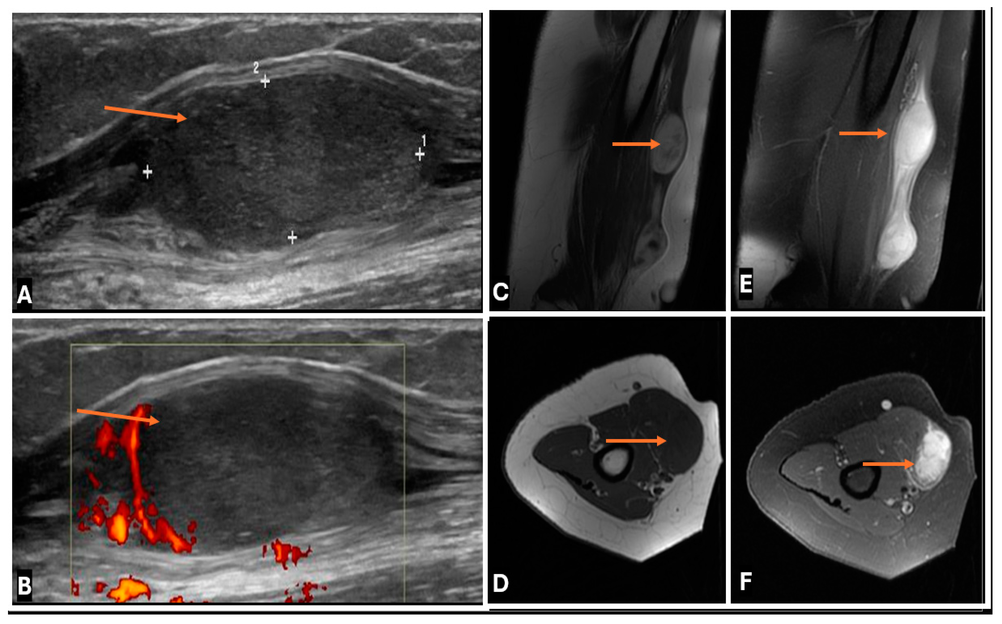 Cancers 17 00246 g027
