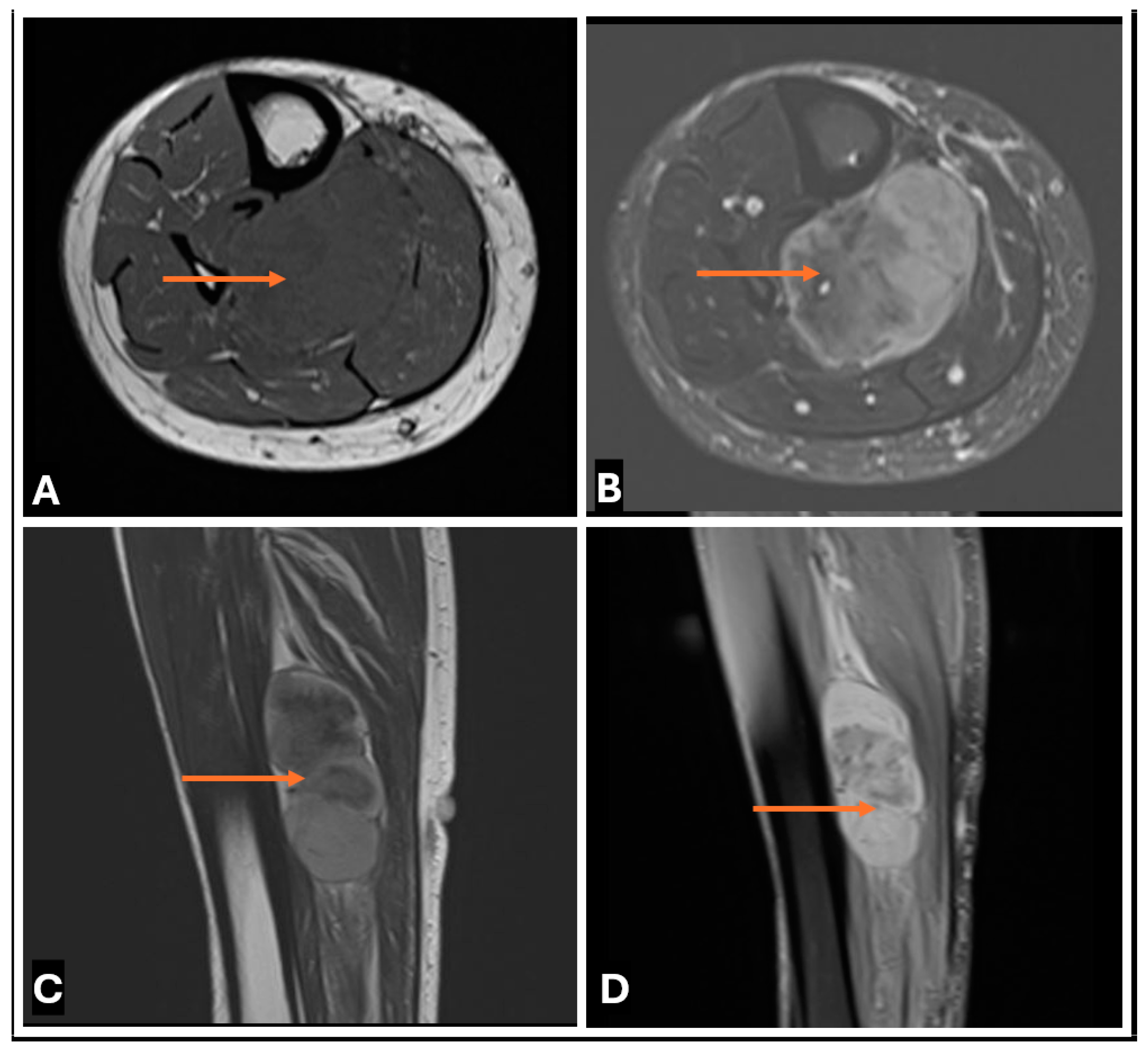 Cancers 17 00246 g028