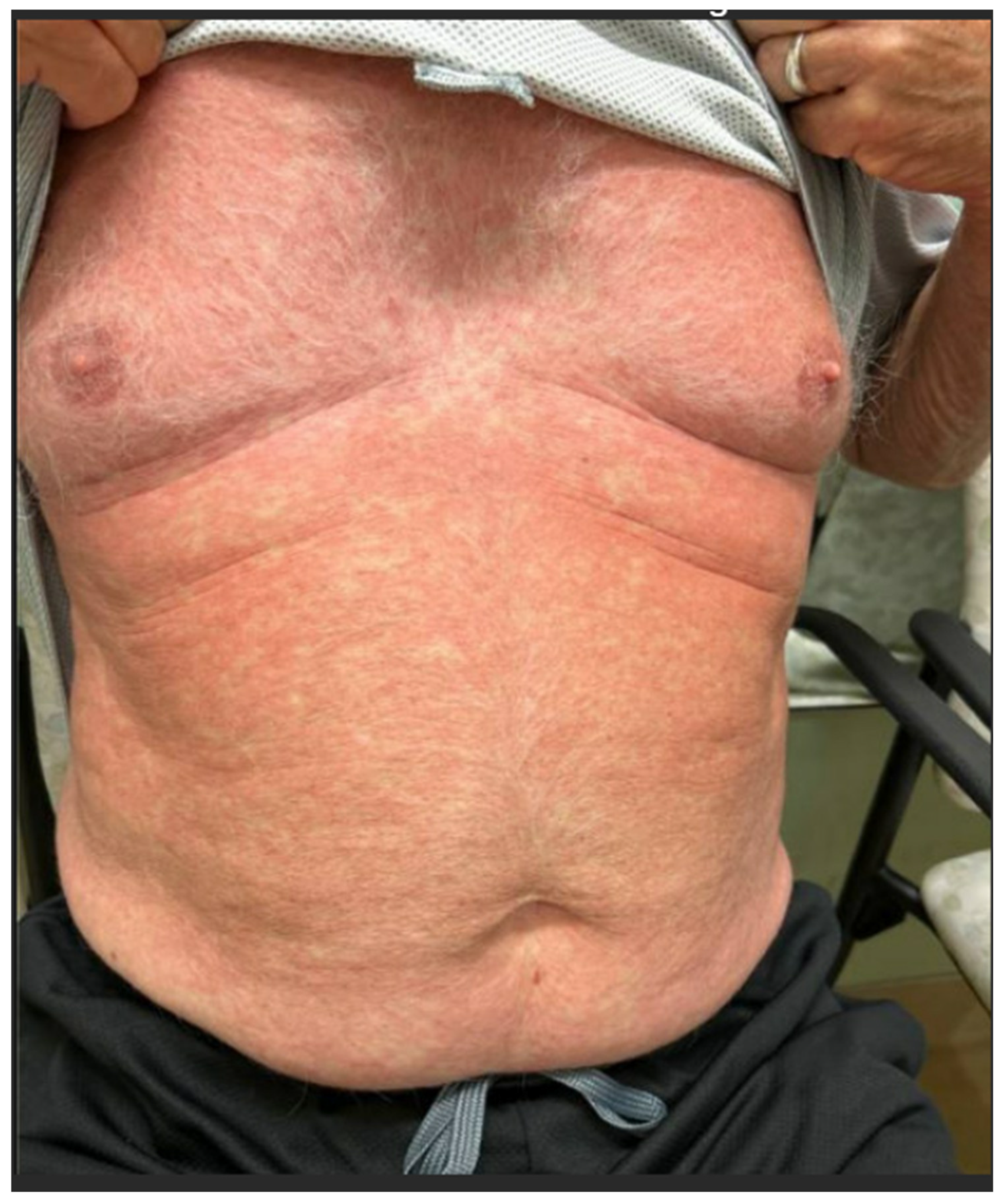 Cancers 17 00251 g001