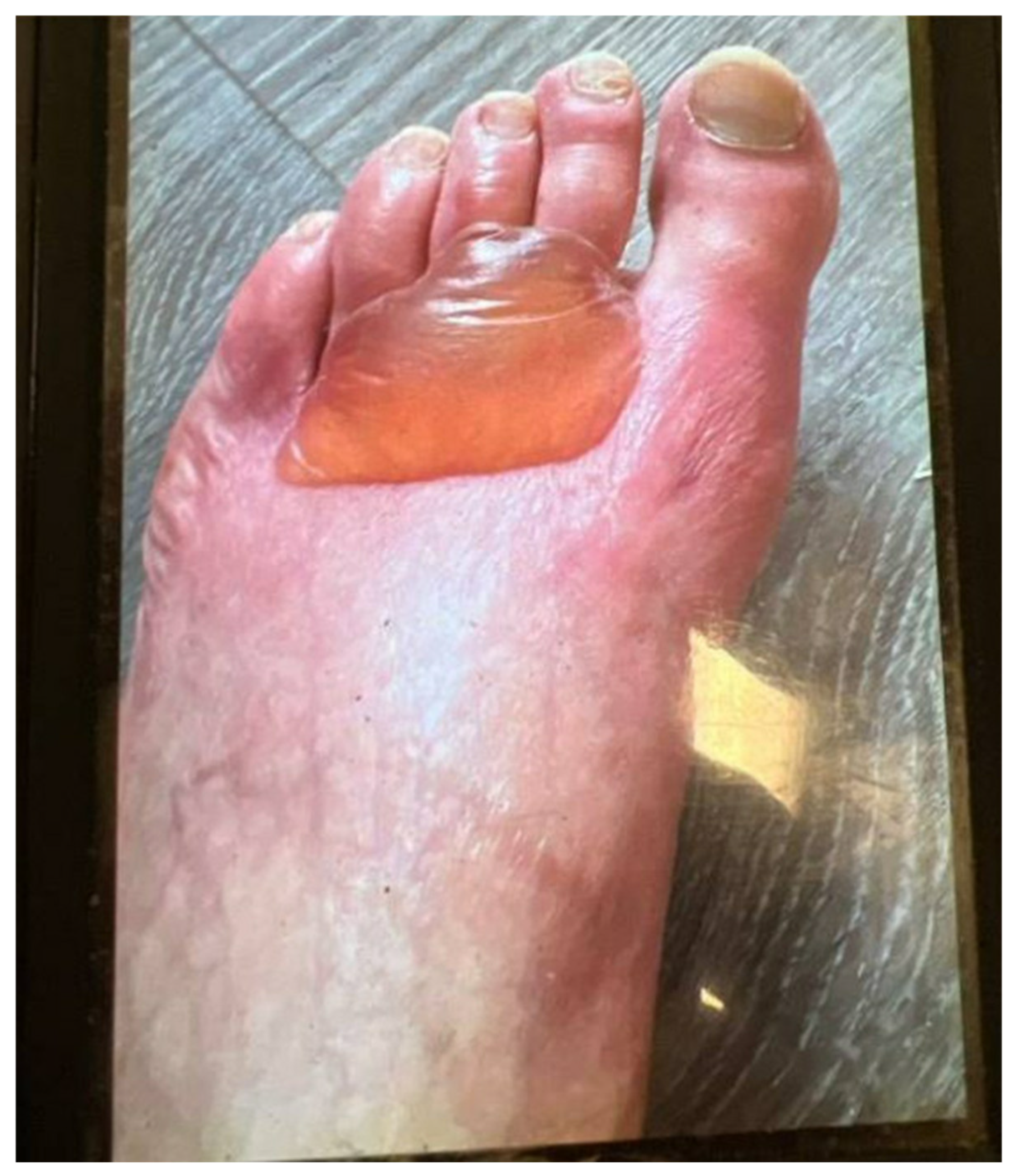 Cancers 17 00251 g002