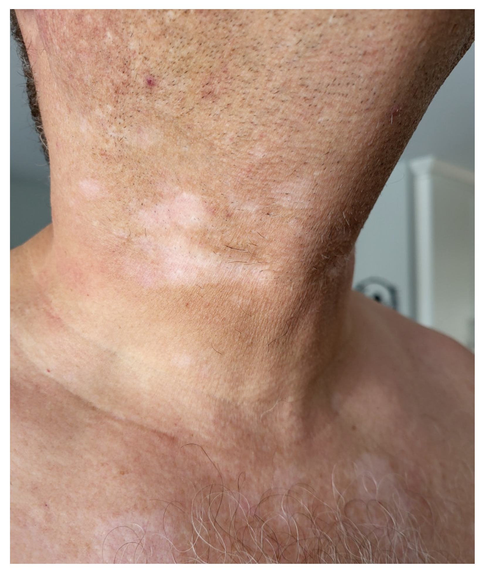 Cancers 17 00251 g003