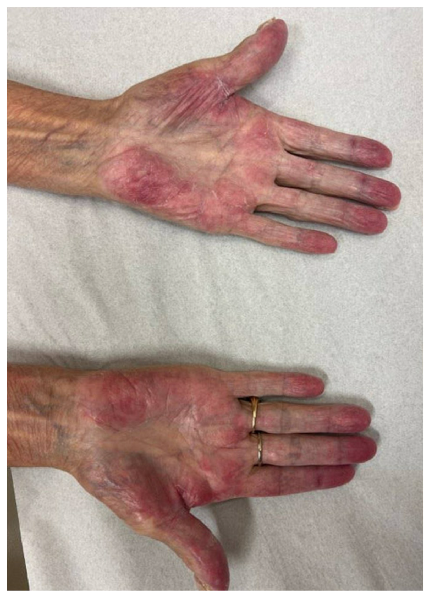 Cancers 17 00251 g004