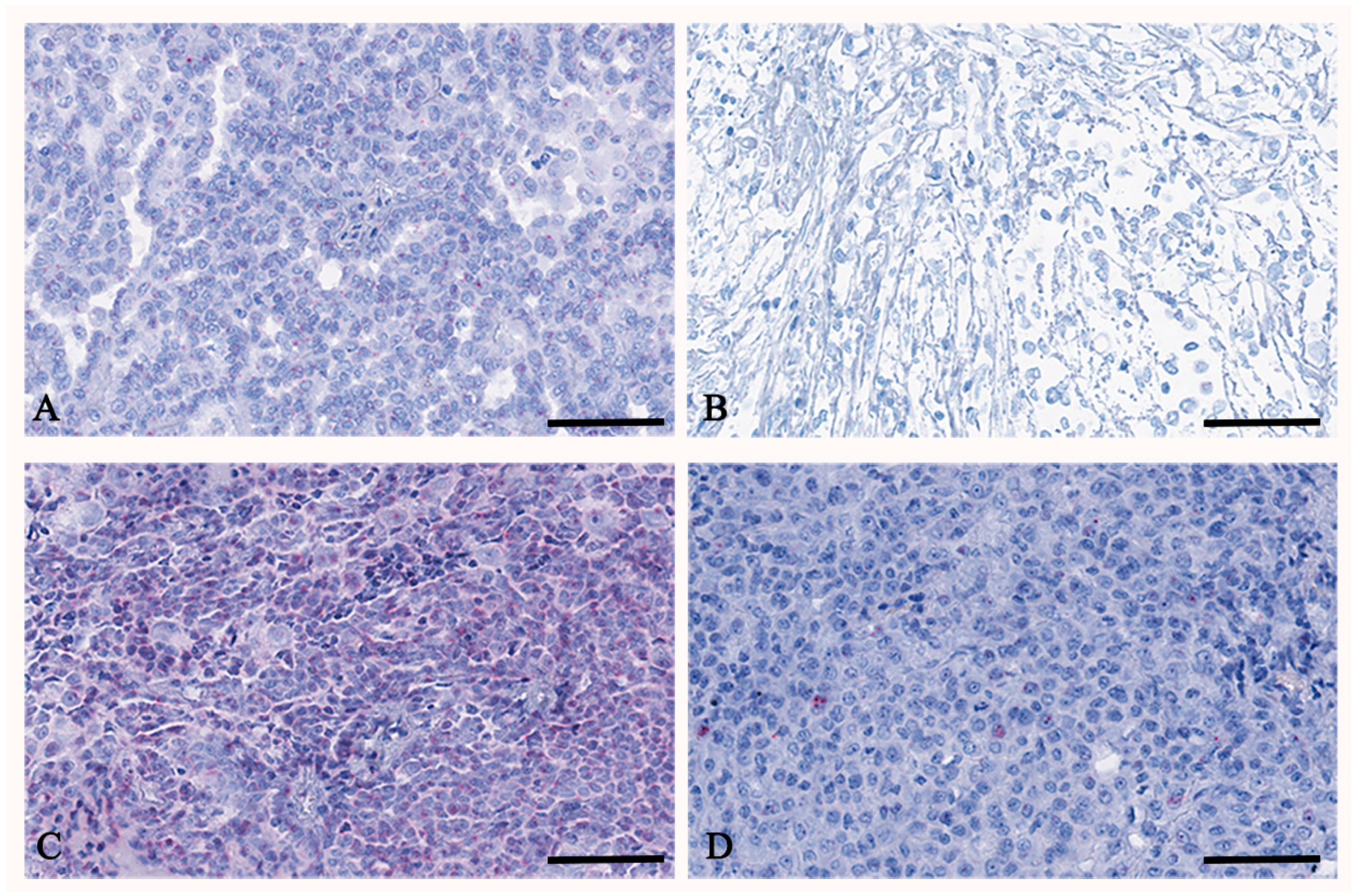 Cancers 17 00252 g002