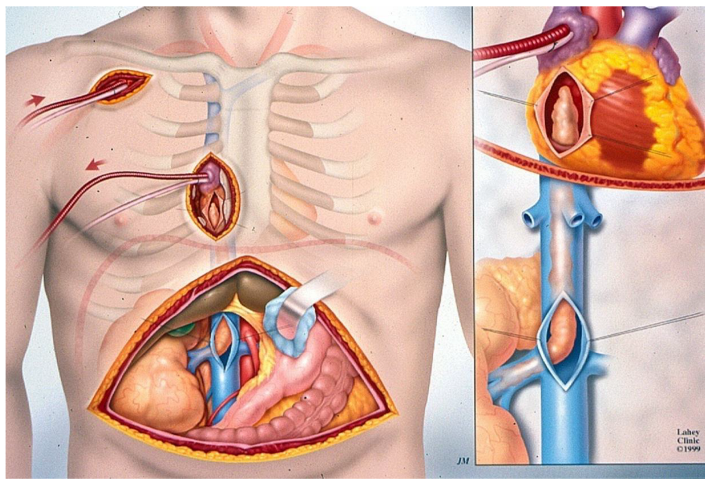 Cancers 17 00264 g002