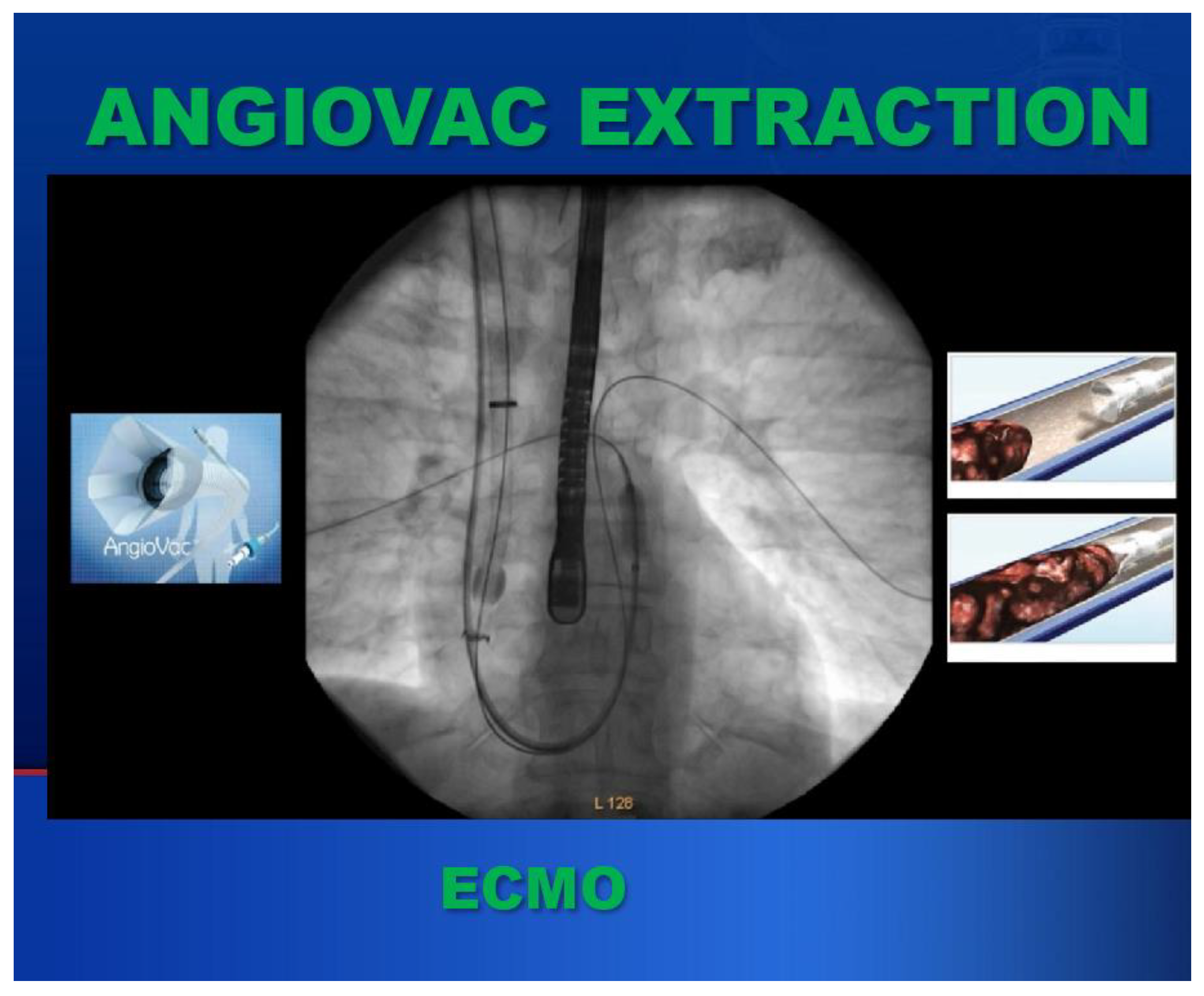 Cancers 17 00264 g003