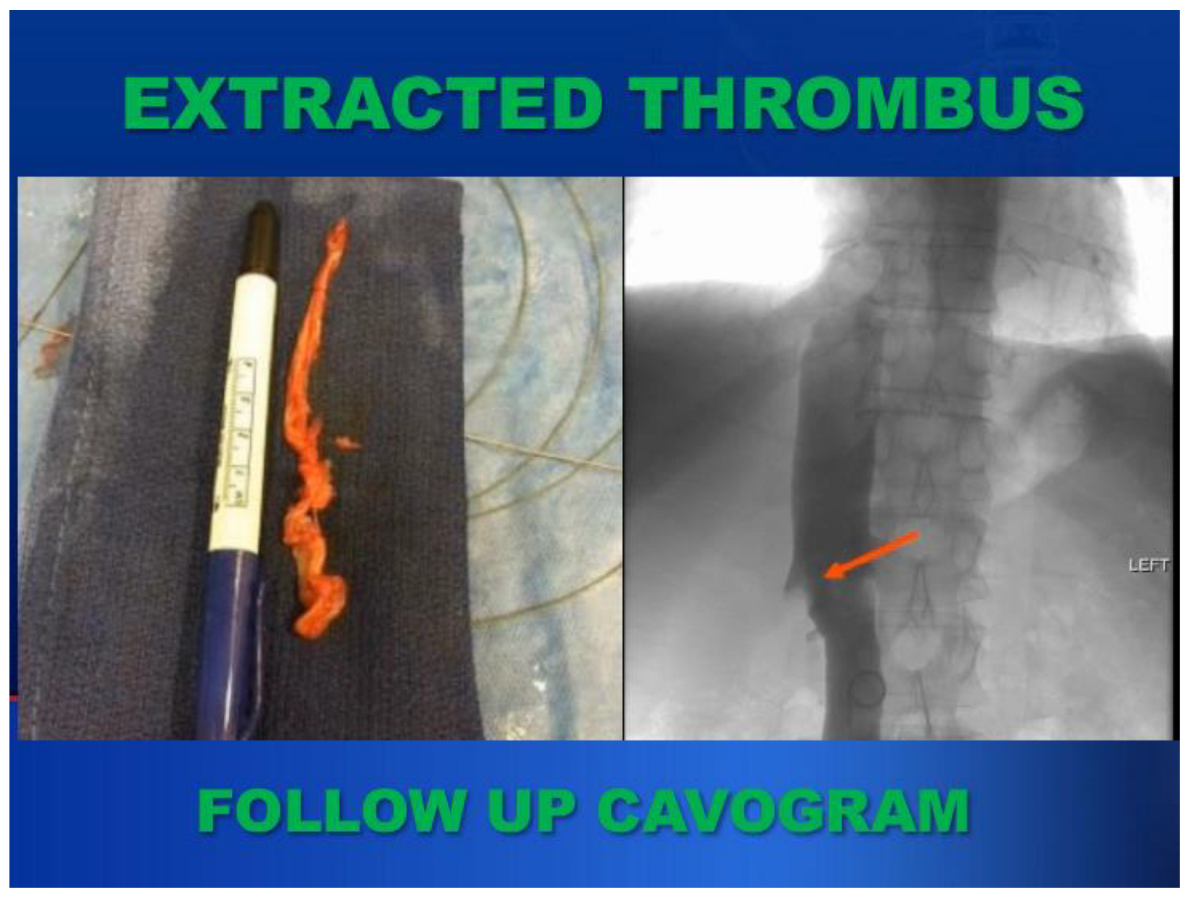 Cancers 17 00264 g004