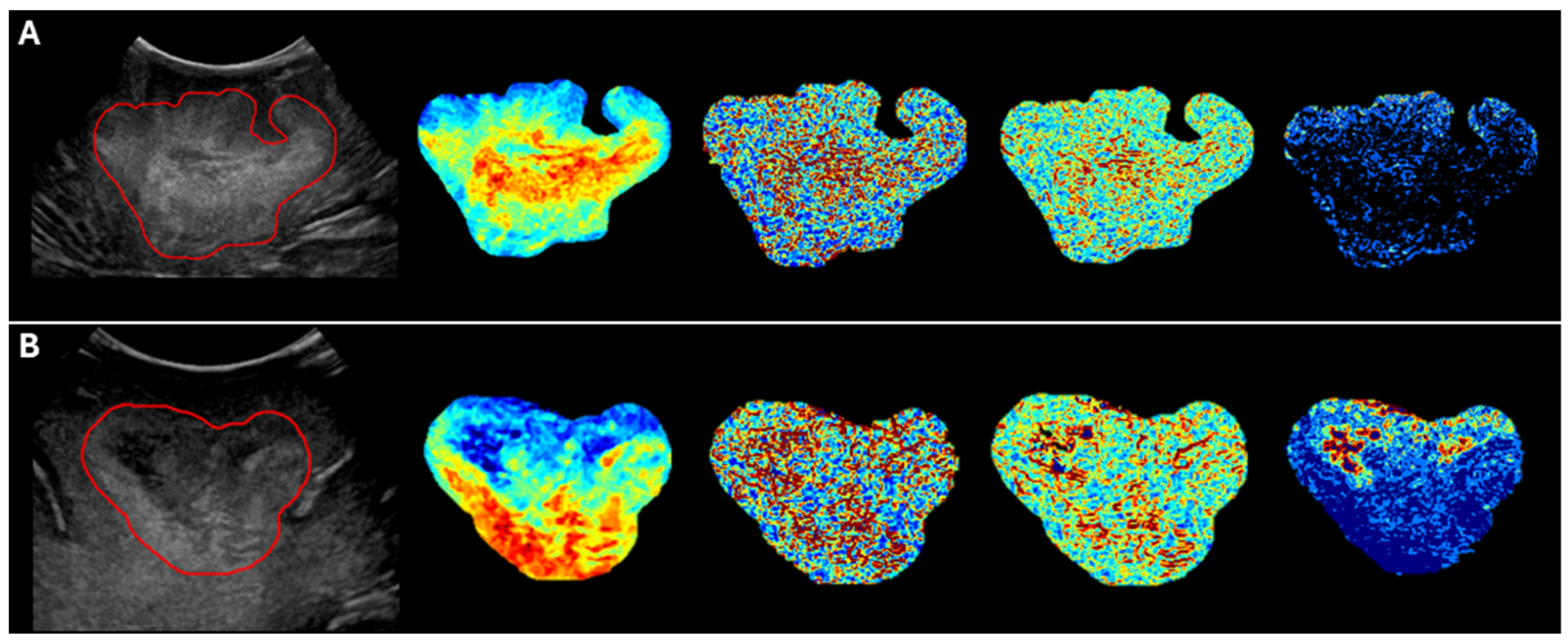 Cancers 17 00280 g004