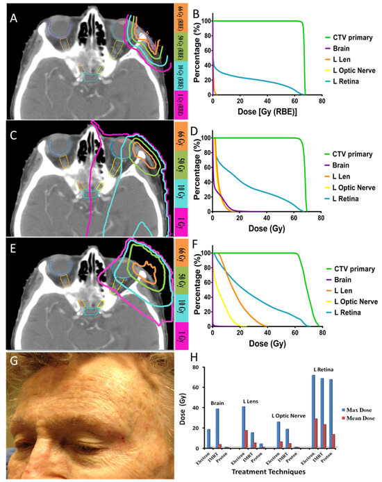 Cancers 17 00327 g001