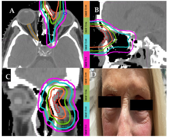 Cancers 17 00327 g002