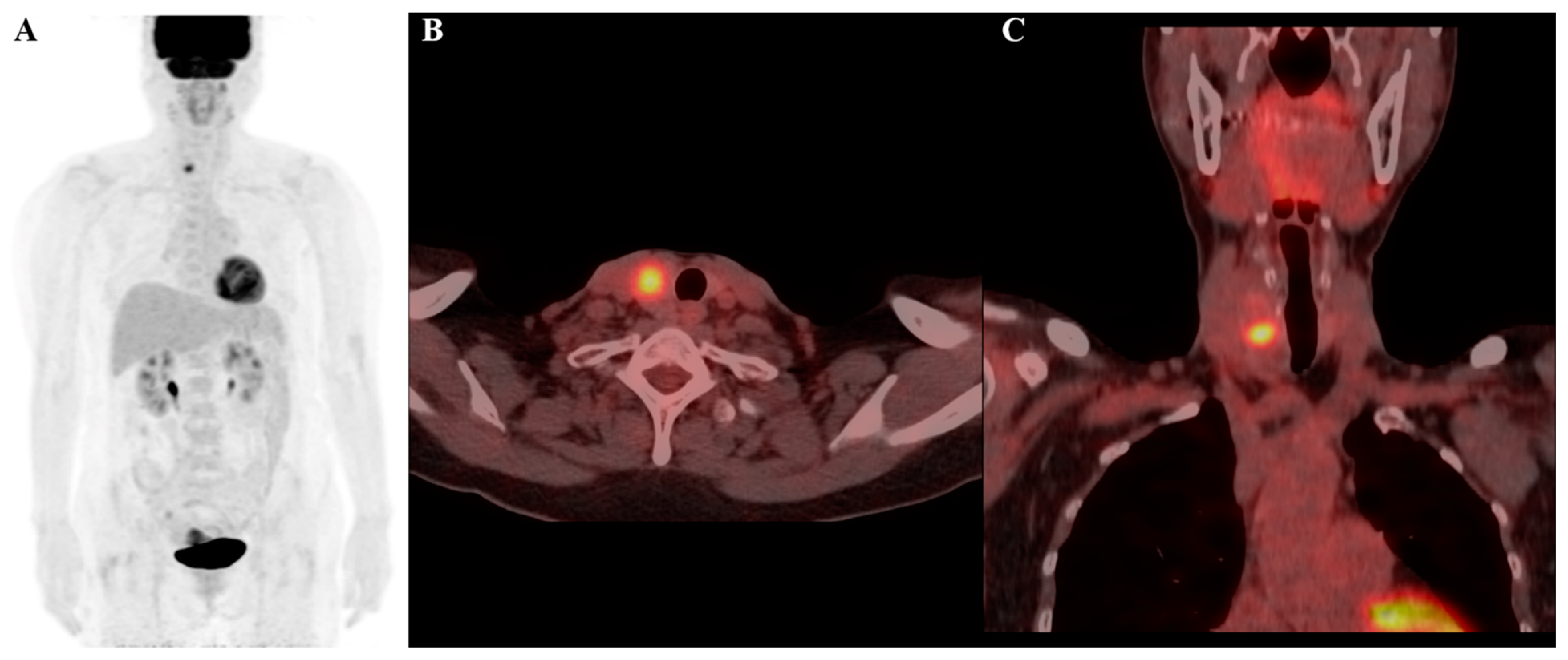 Cancers 17 00331 g004