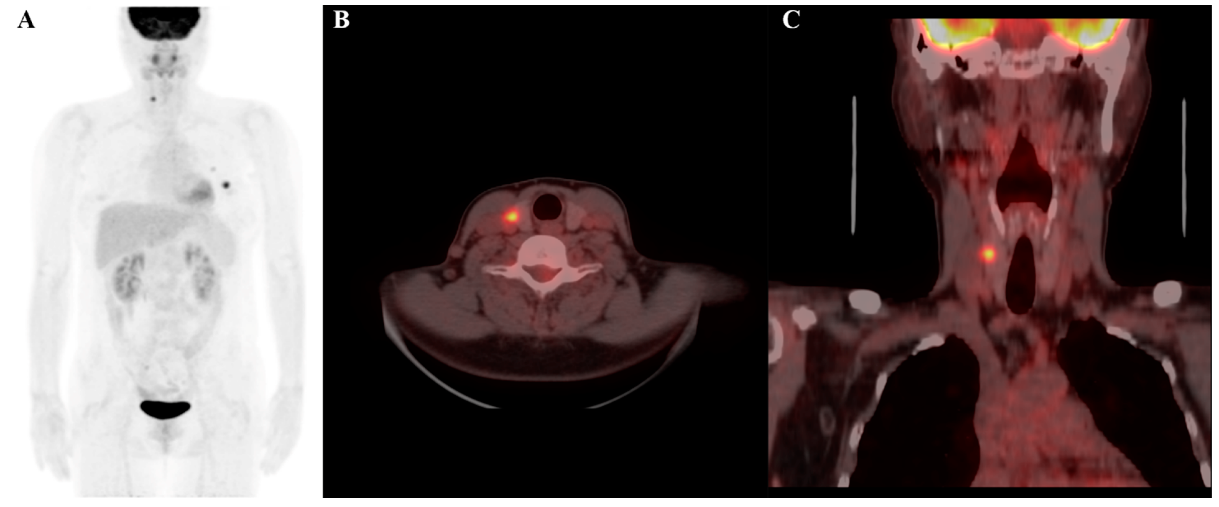 Cancers 17 00331 g005