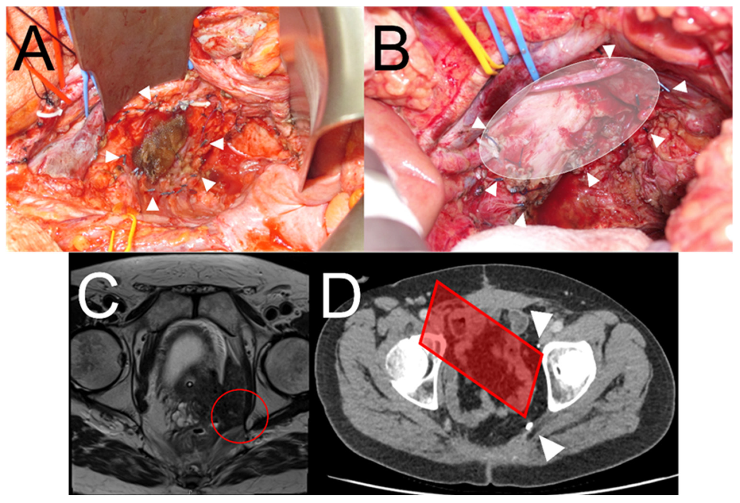 Cancers 17 00341 g002