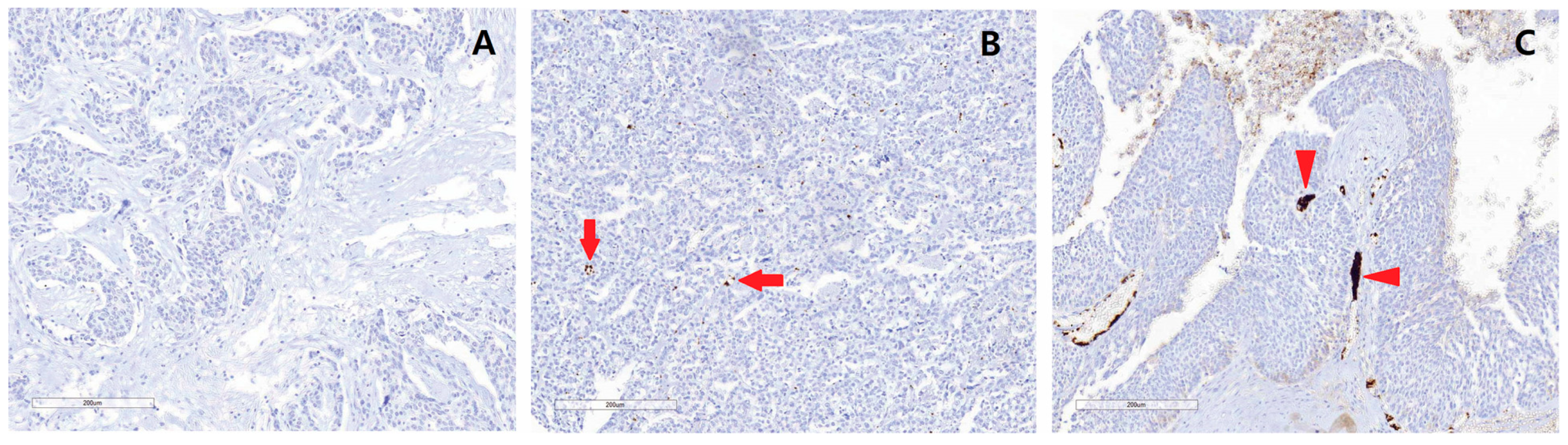 Cancers 17 00345 g001