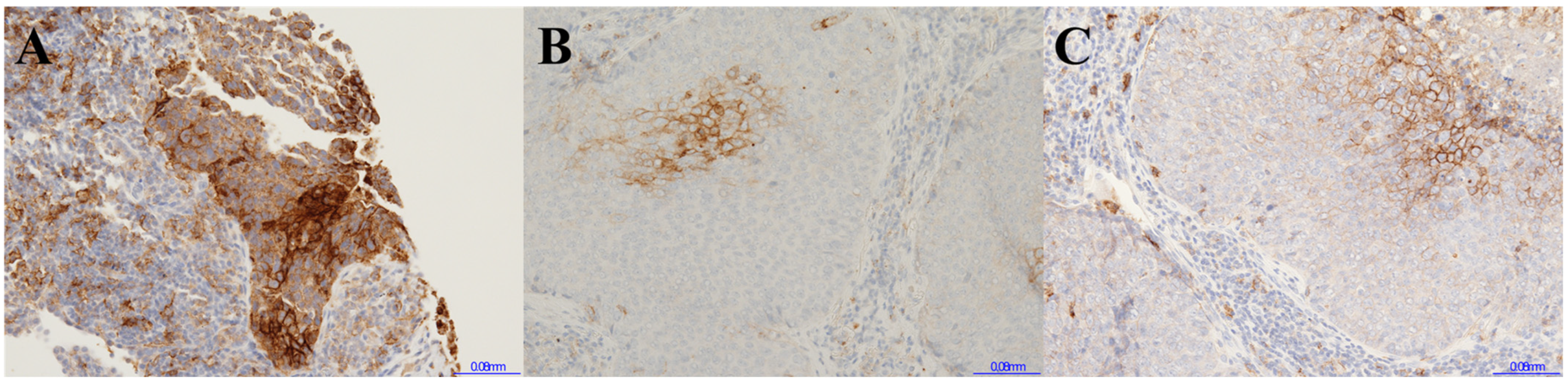 Cancers 17 00398 g002