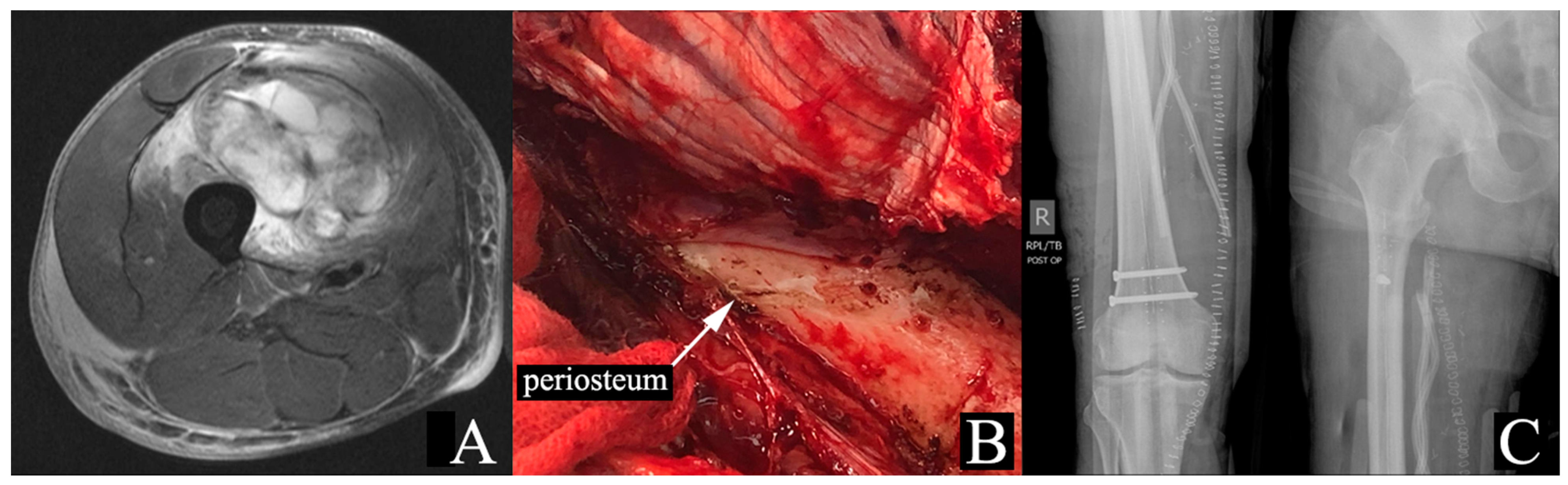 Cancers 17 00401 g001