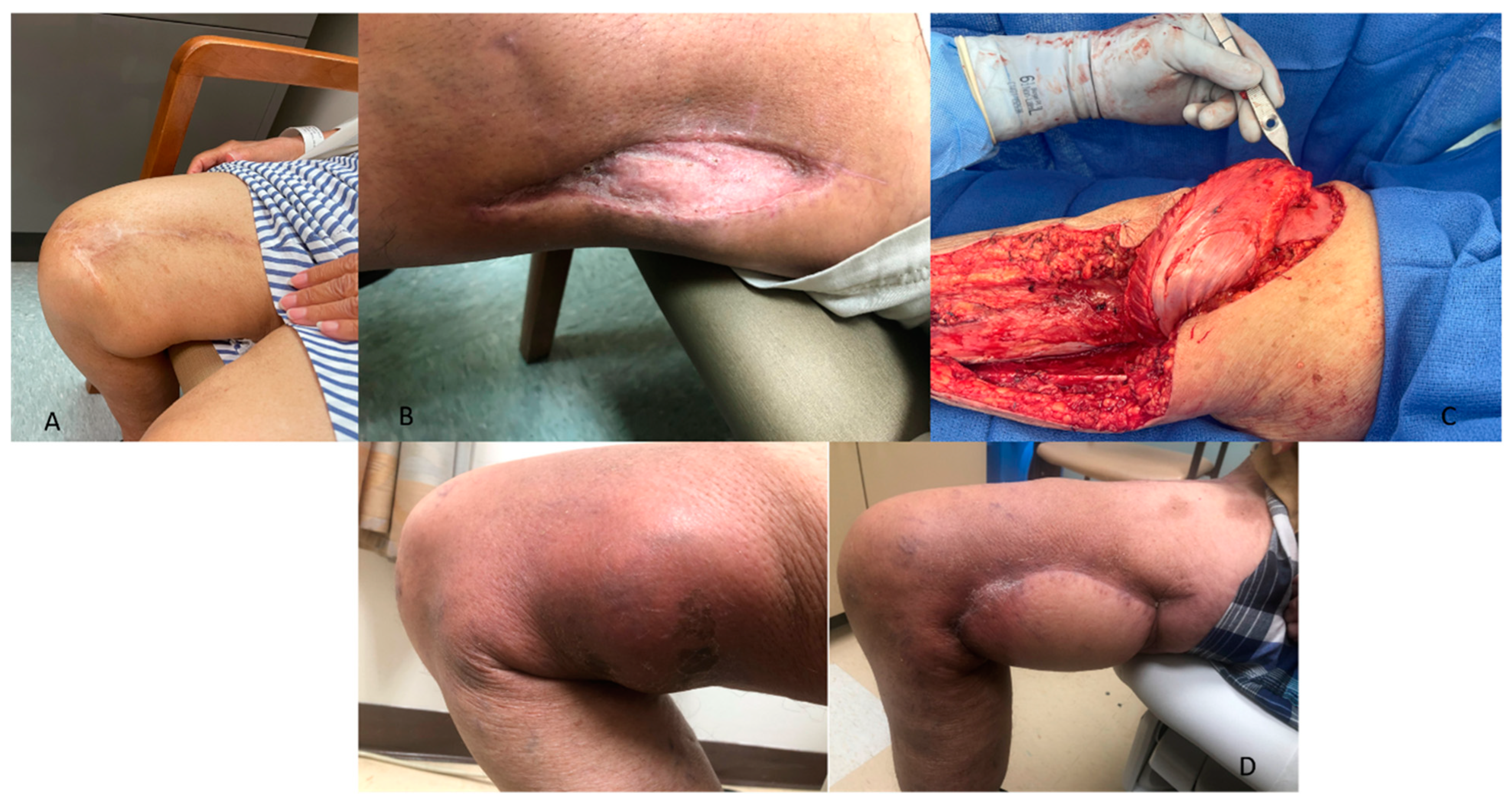 Cancers 17 00401 g002