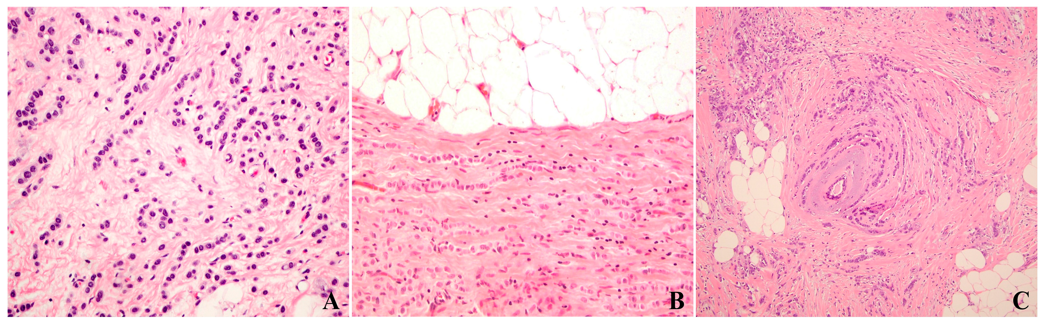 Cancers 17 00417 g001