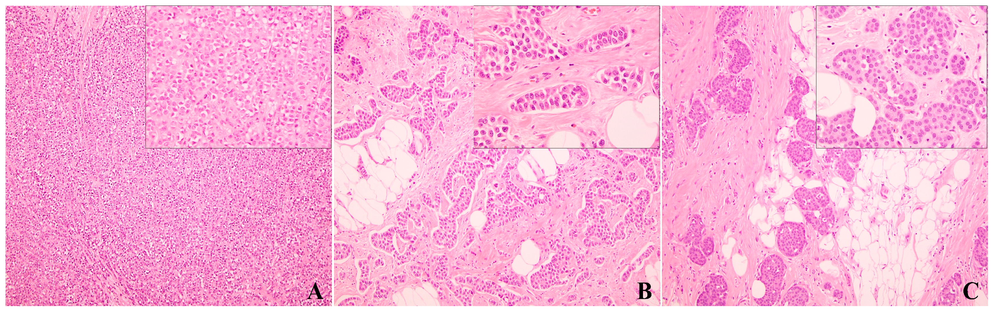 Cancers 17 00417 g002