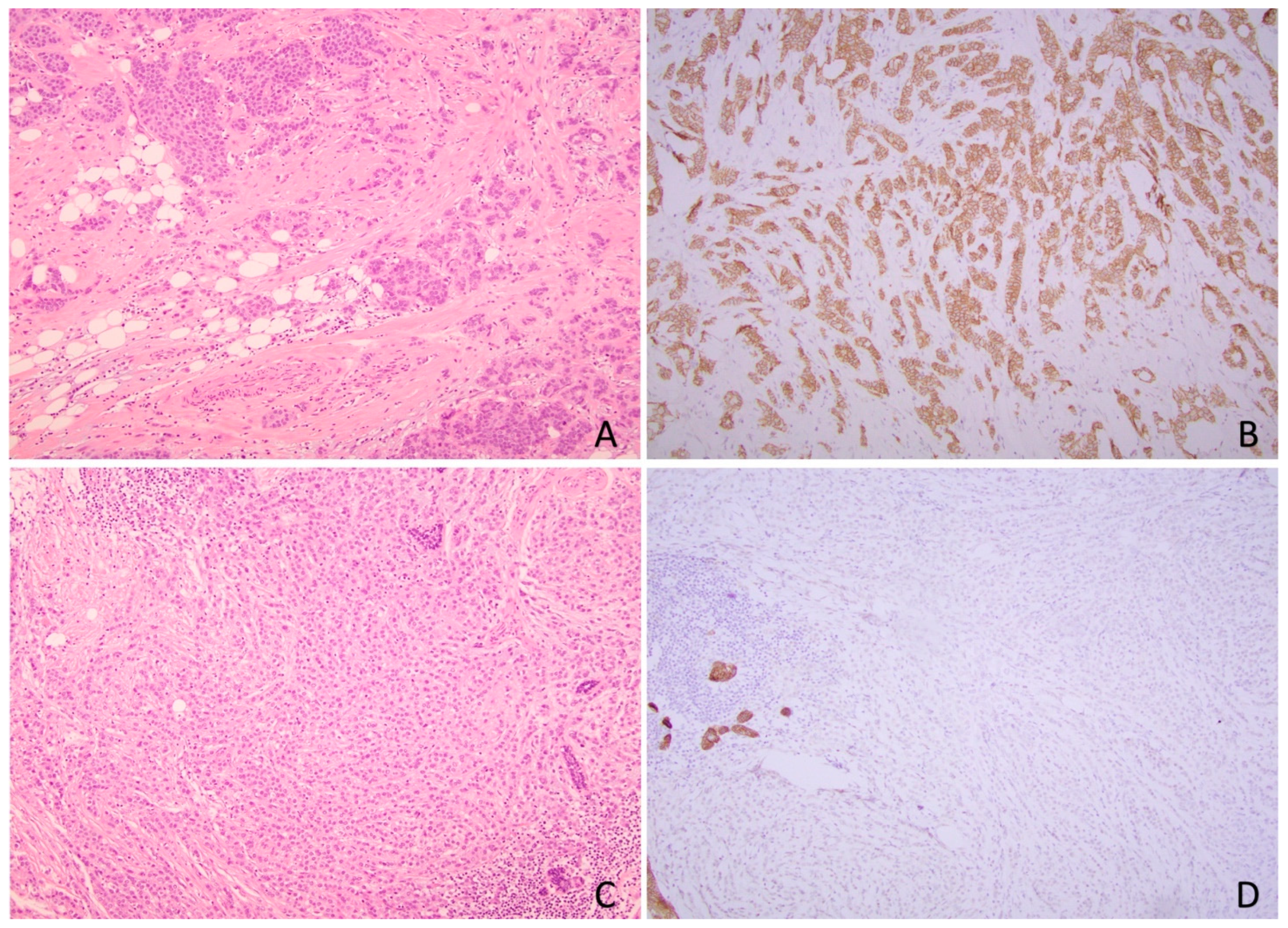 Cancers 17 00417 g004