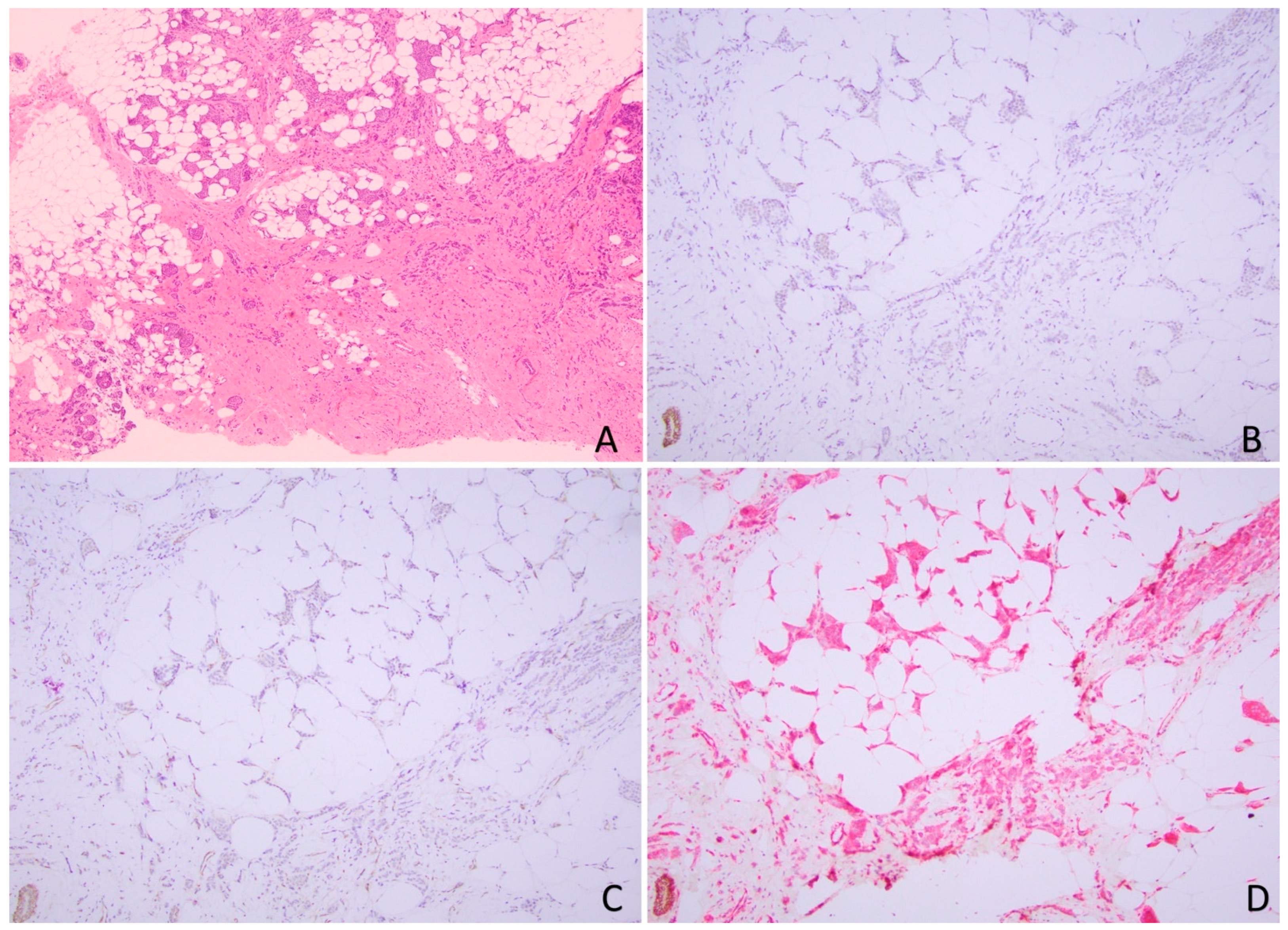 Cancers 17 00417 g005