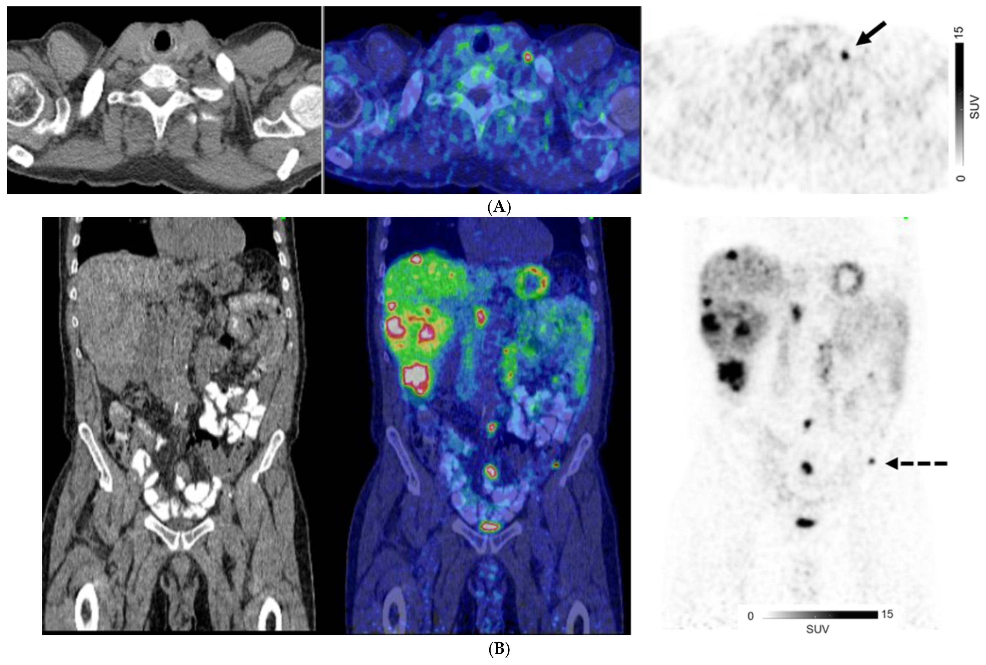 Cancers 17 00434 g002a