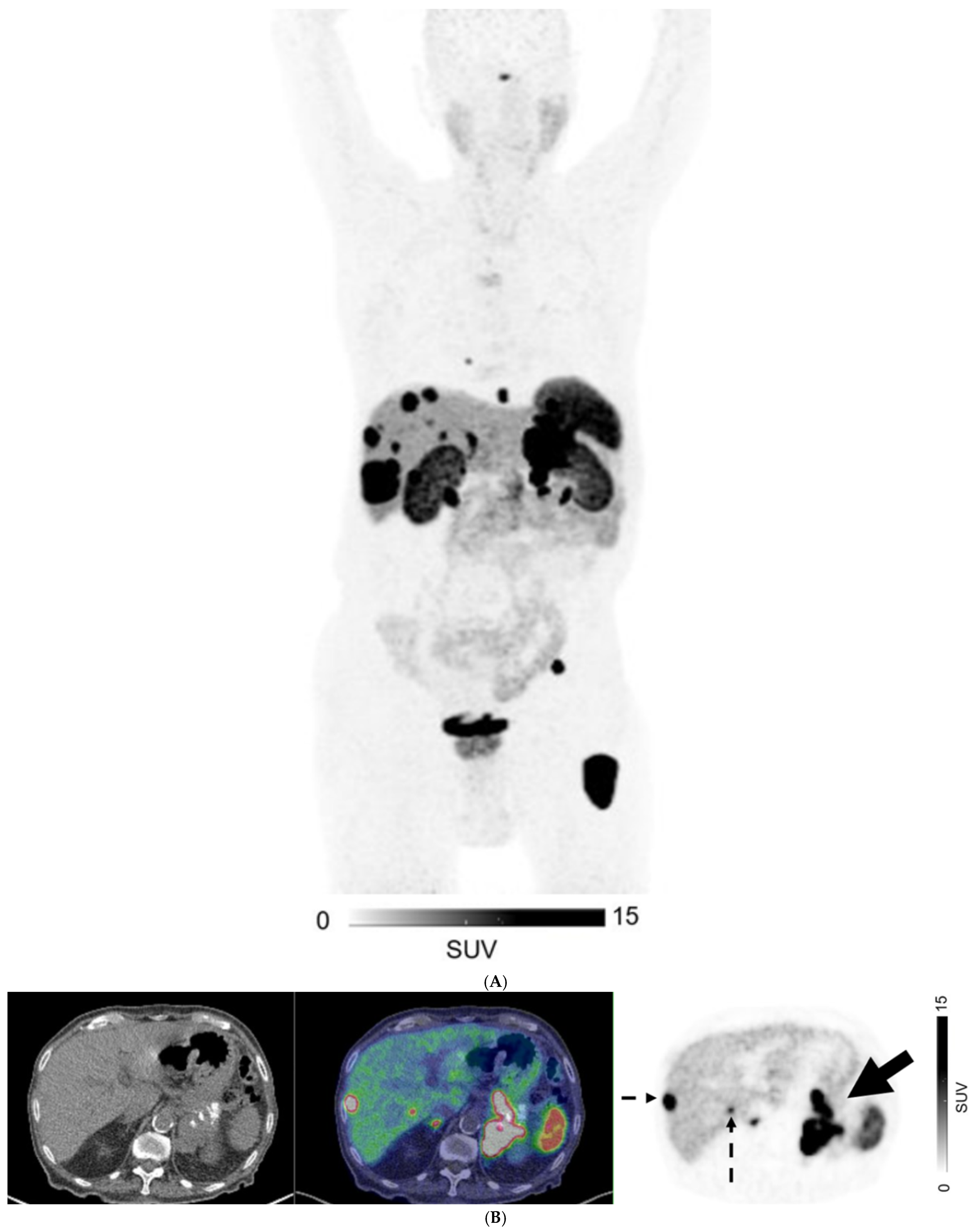 Cancers 17 00434 g003a