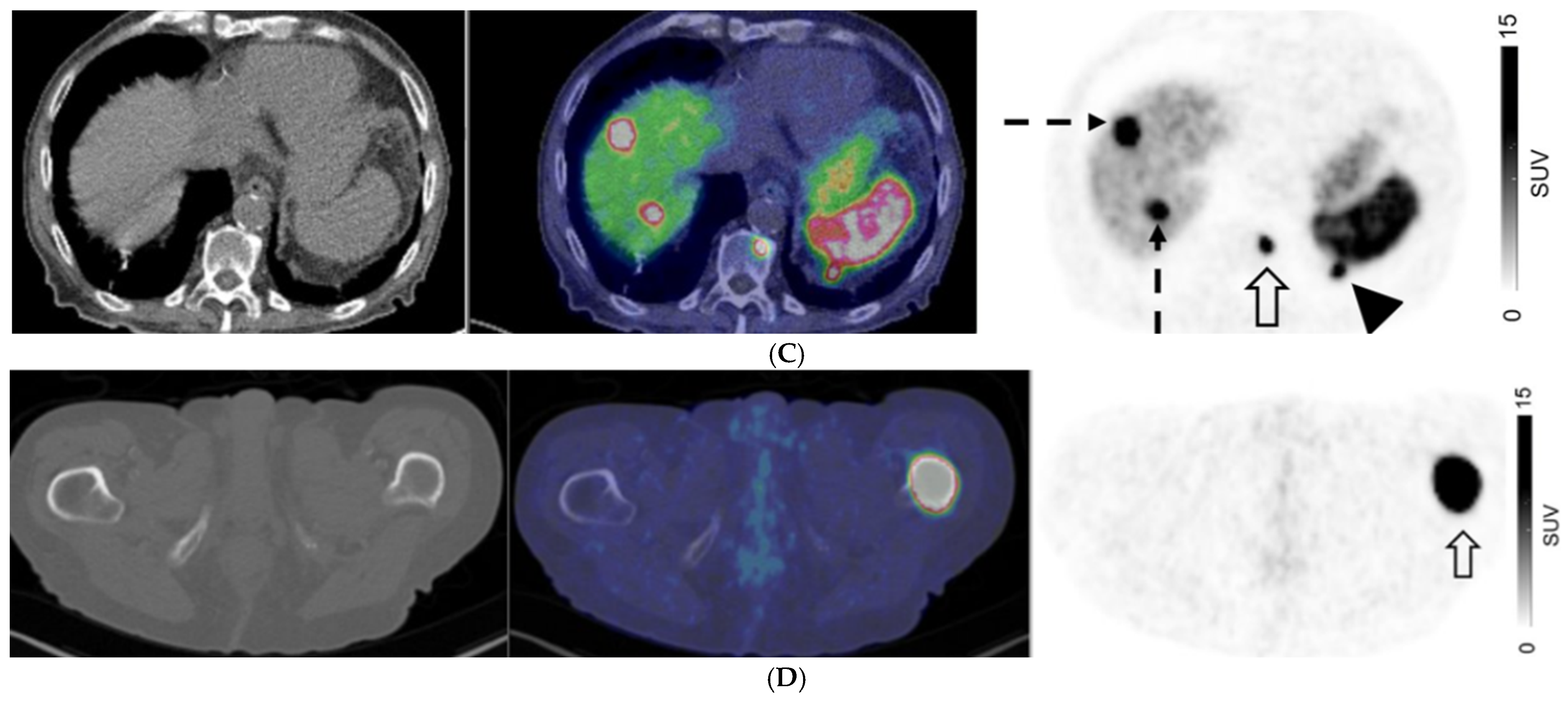 Cancers 17 00434 g003b