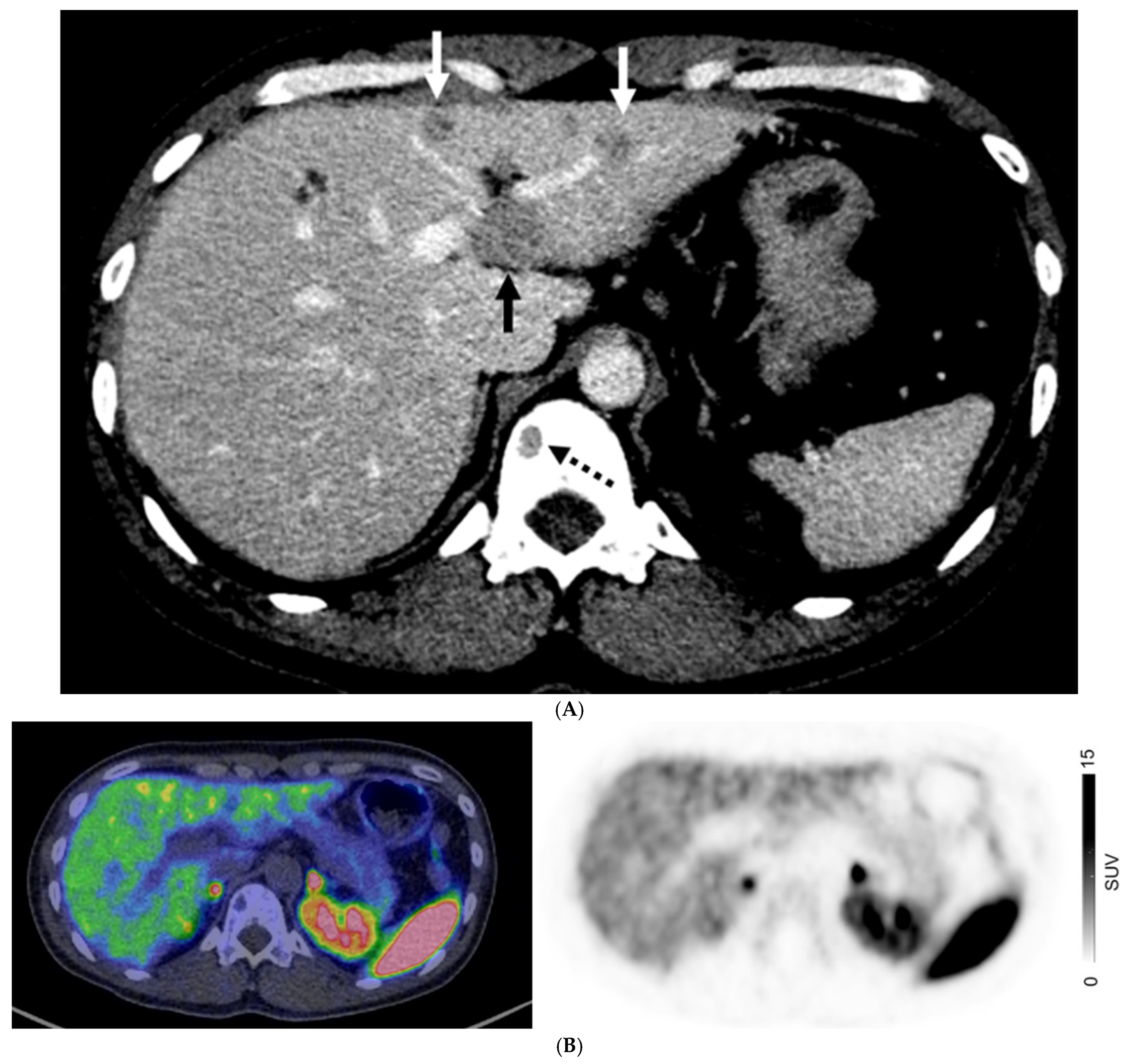 Cancers 17 00434 g004