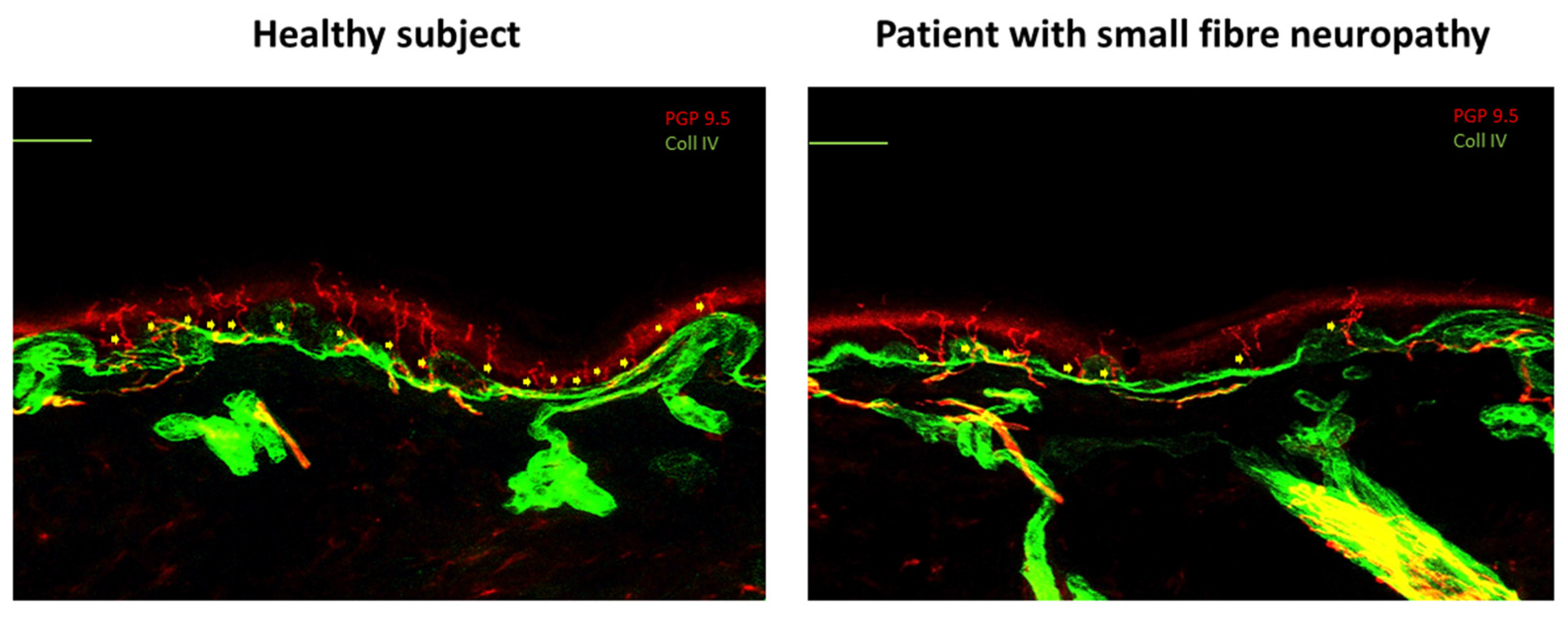 Cancers 17 00460 g002